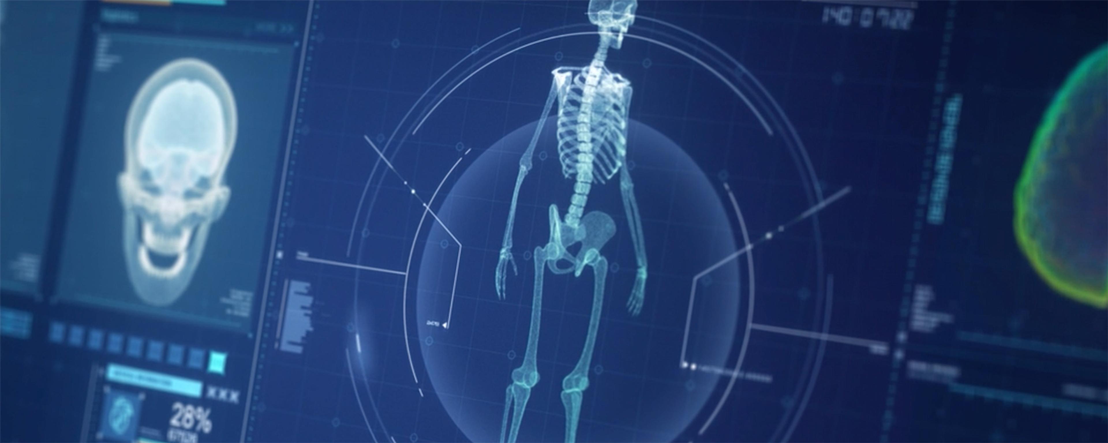 Digital illustration of a human skeleton scan on a futuristic medical interface, showing data and analysis metrics.