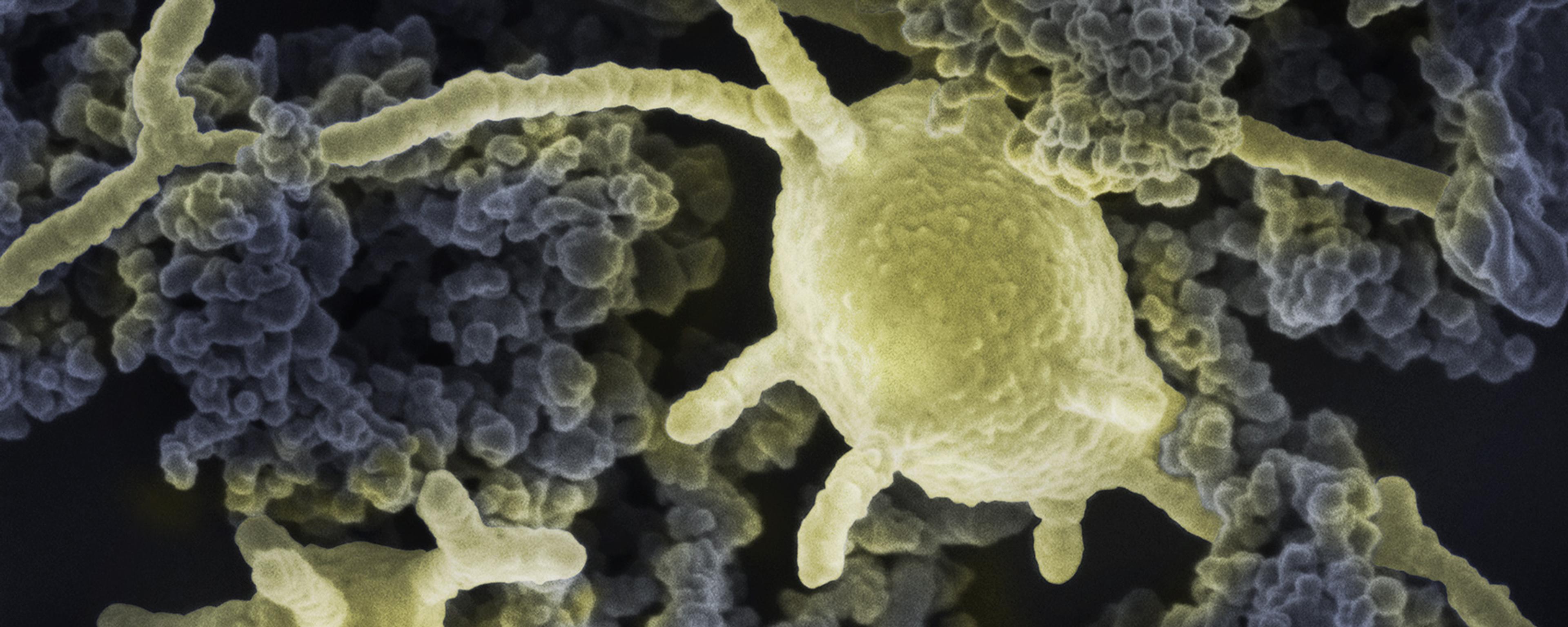 Coloured scanning electron micrograph of yellow bacteria surrounded by dark grey particulate matter.