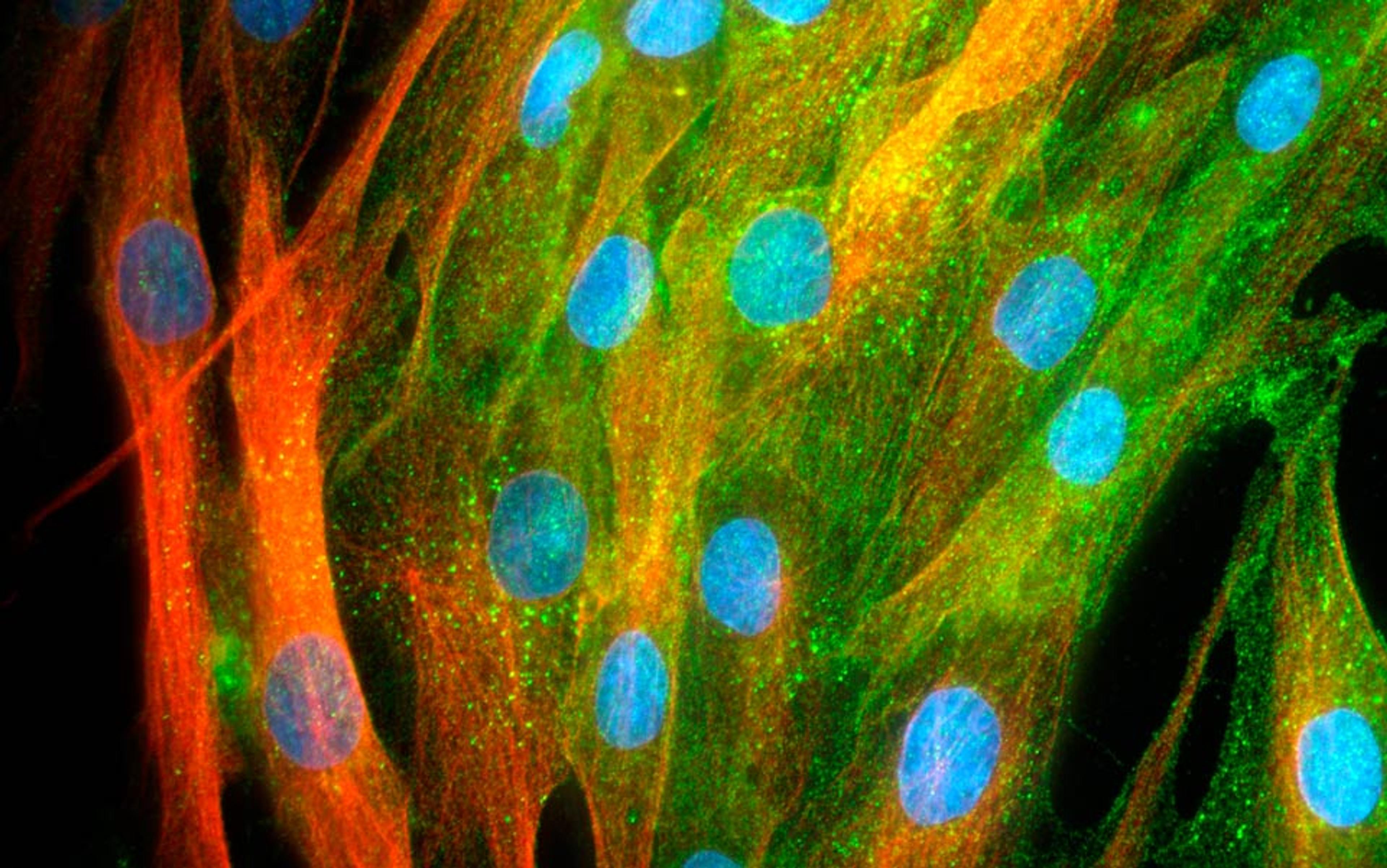 Fluorescent microscopy image of cells with blue nuclei, green microtubules and red actin filaments.