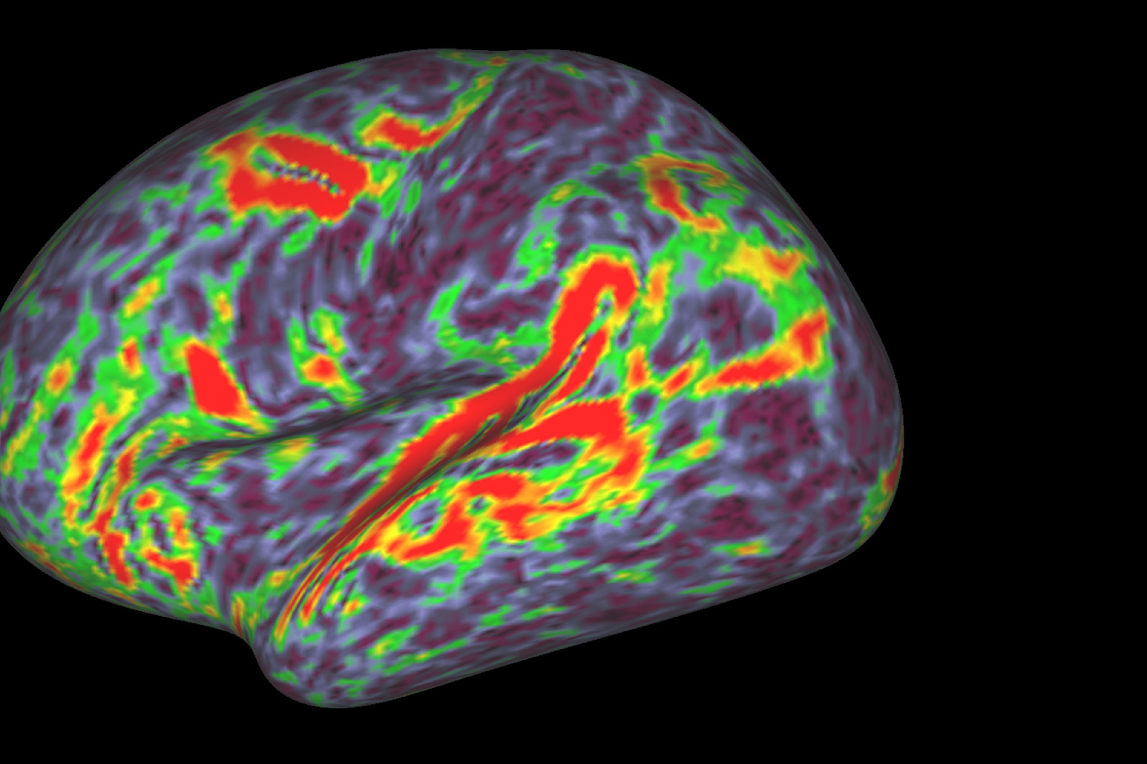 Colourful brain activity scan with red, green, and purple regions, depicted against a black background.