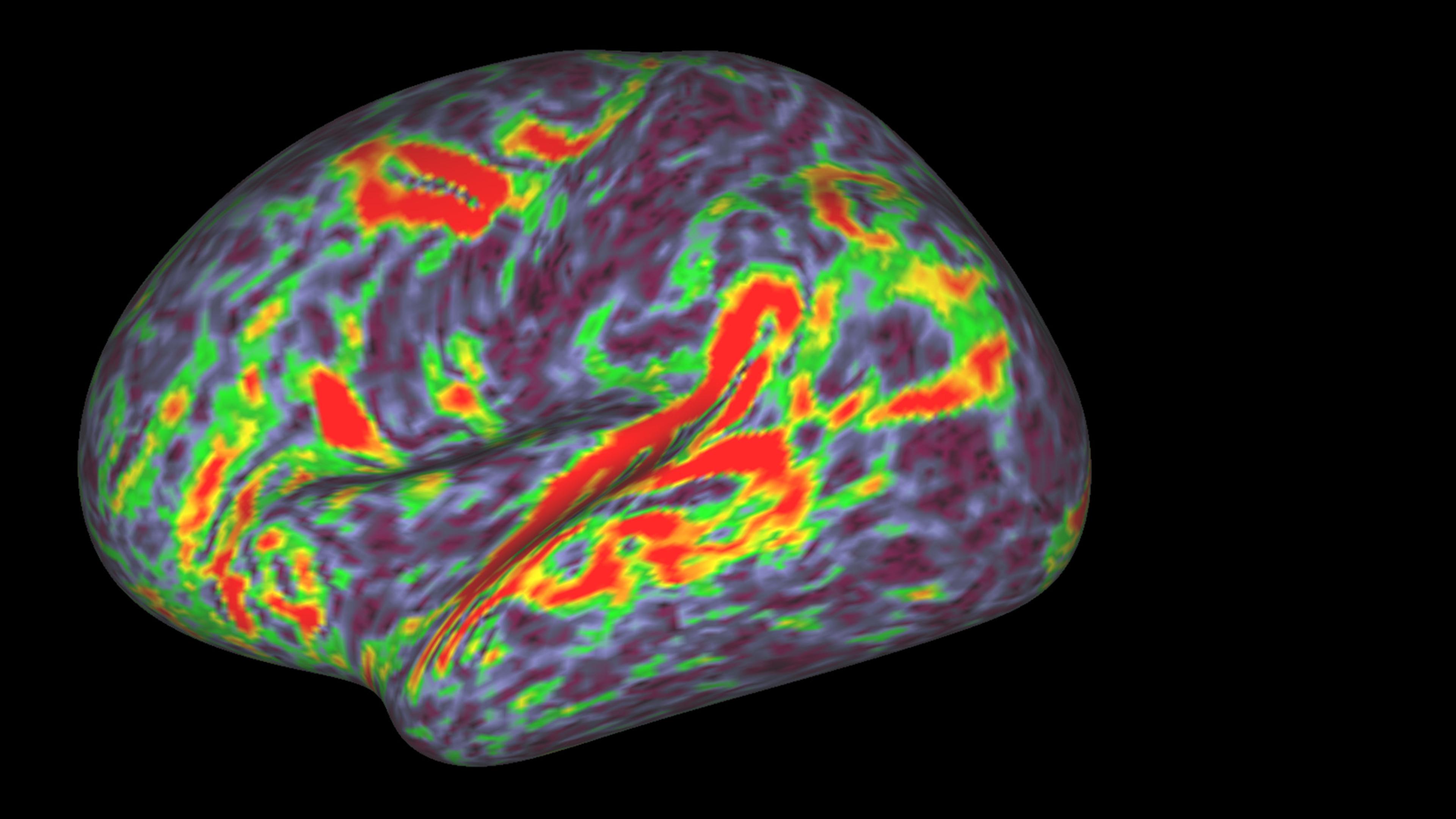 Colourful brain activity scan with red, green, and purple regions, depicted against a black background.