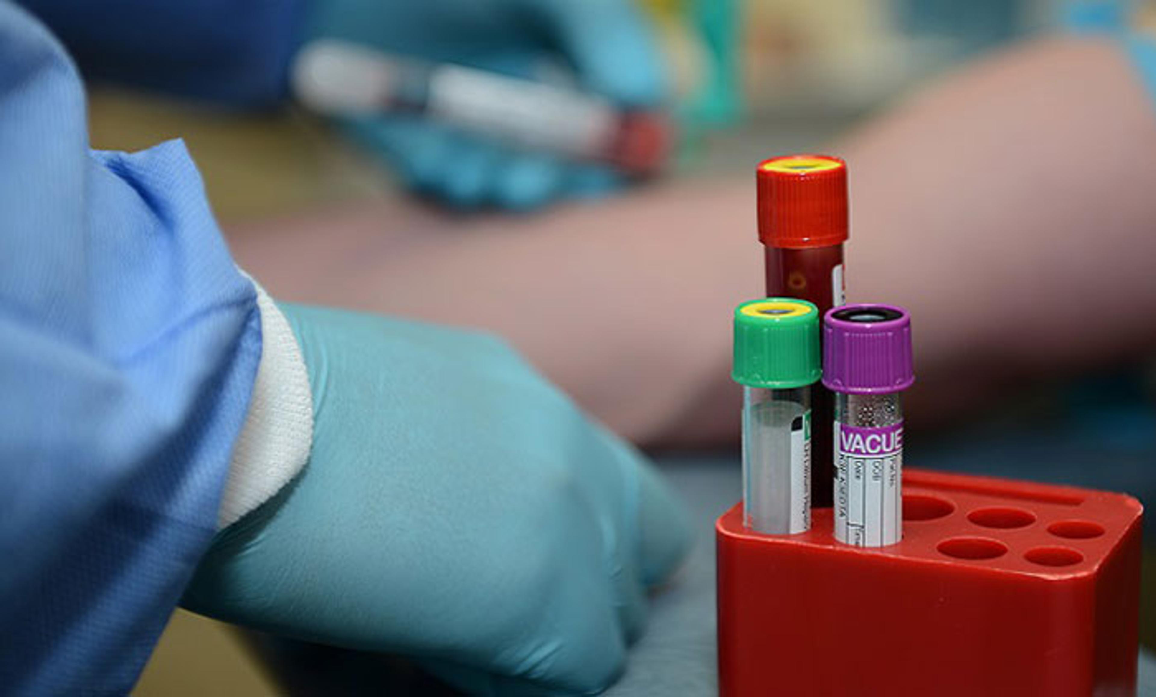 Gloved hands handling vials in a lab. Three coloured-capped vials are in a red holder, focusing on medical equipment.