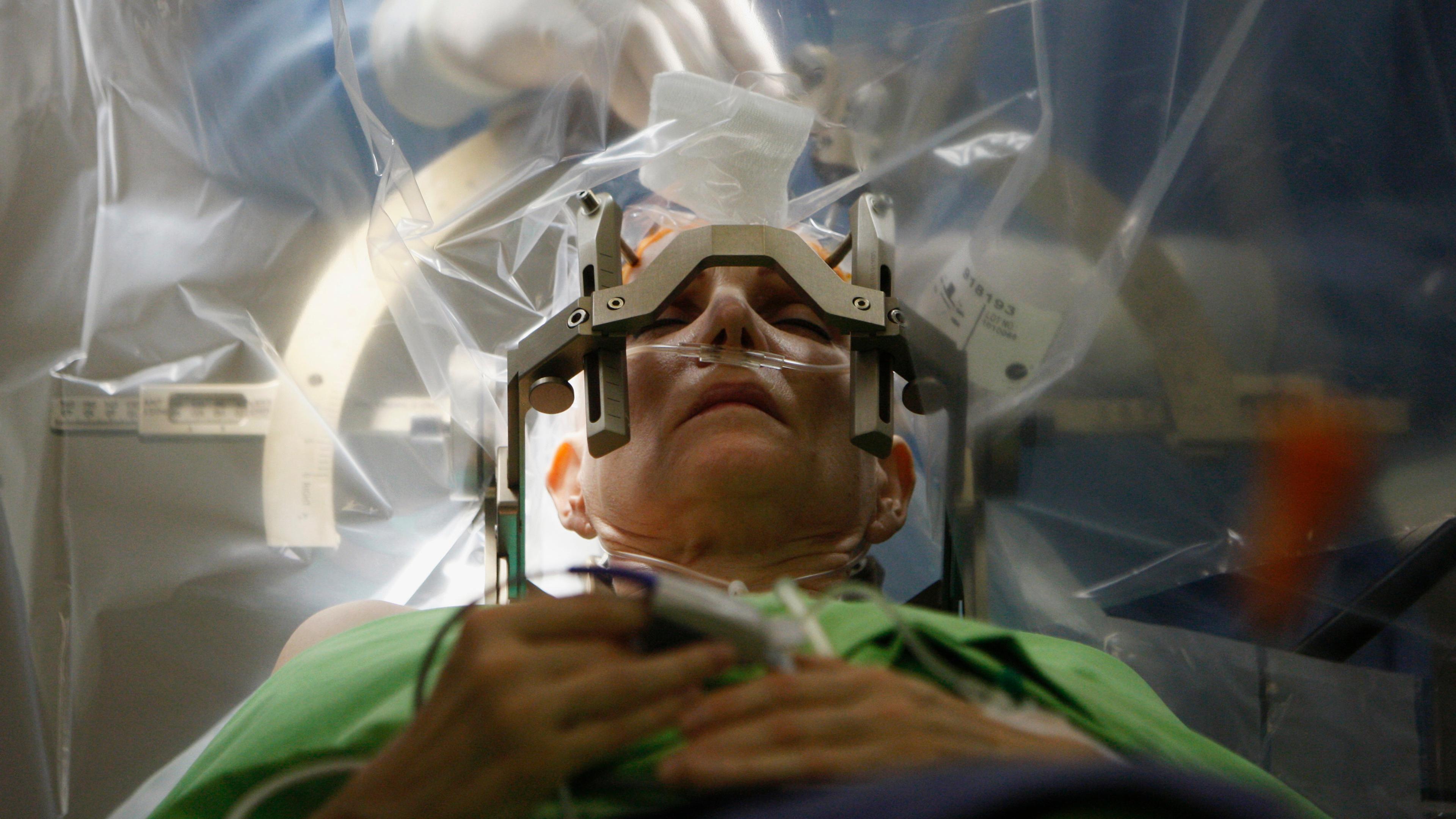 Photo of a patient in surgery with head stabilised by a frame; medical staff holding instruments in the background.
