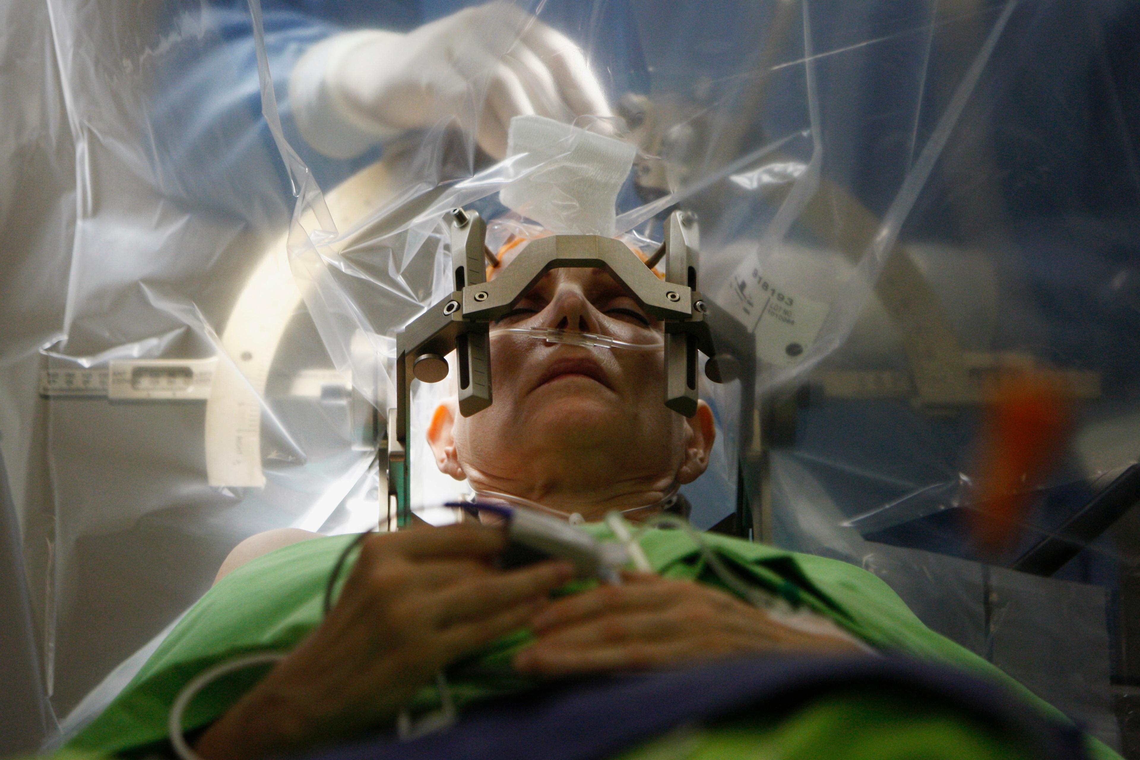 Photo of a patient in surgery with head stabilised by a frame; medical staff holding instruments in the background.