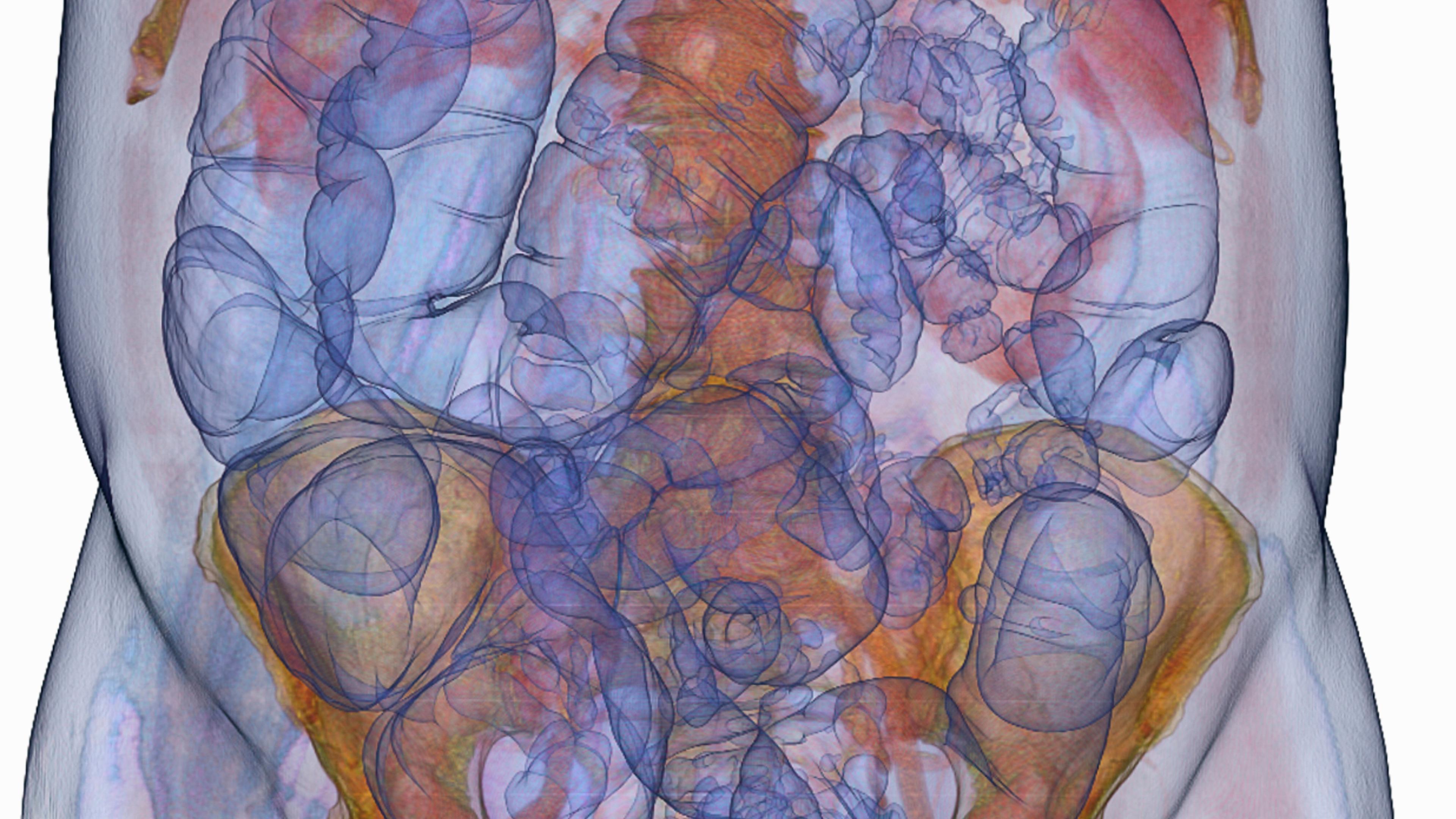 Coloured medical scan of human abdomen showing internal organs with blue and orange highlights, digital imaging.