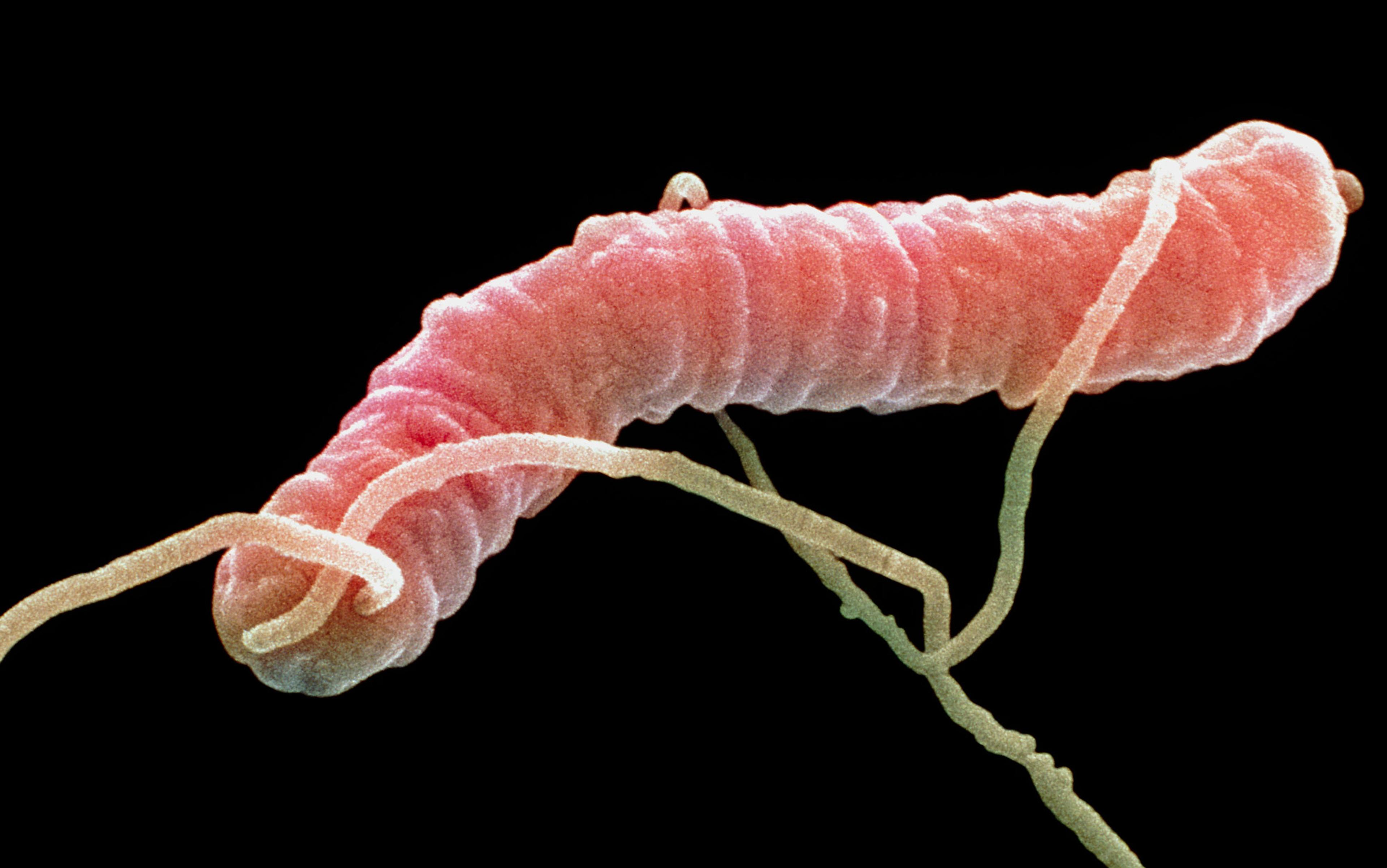 Coloured scanning electron micrograph of a Helicobacter pylori bacterium showing its spiral shape and filaments, on a black background.