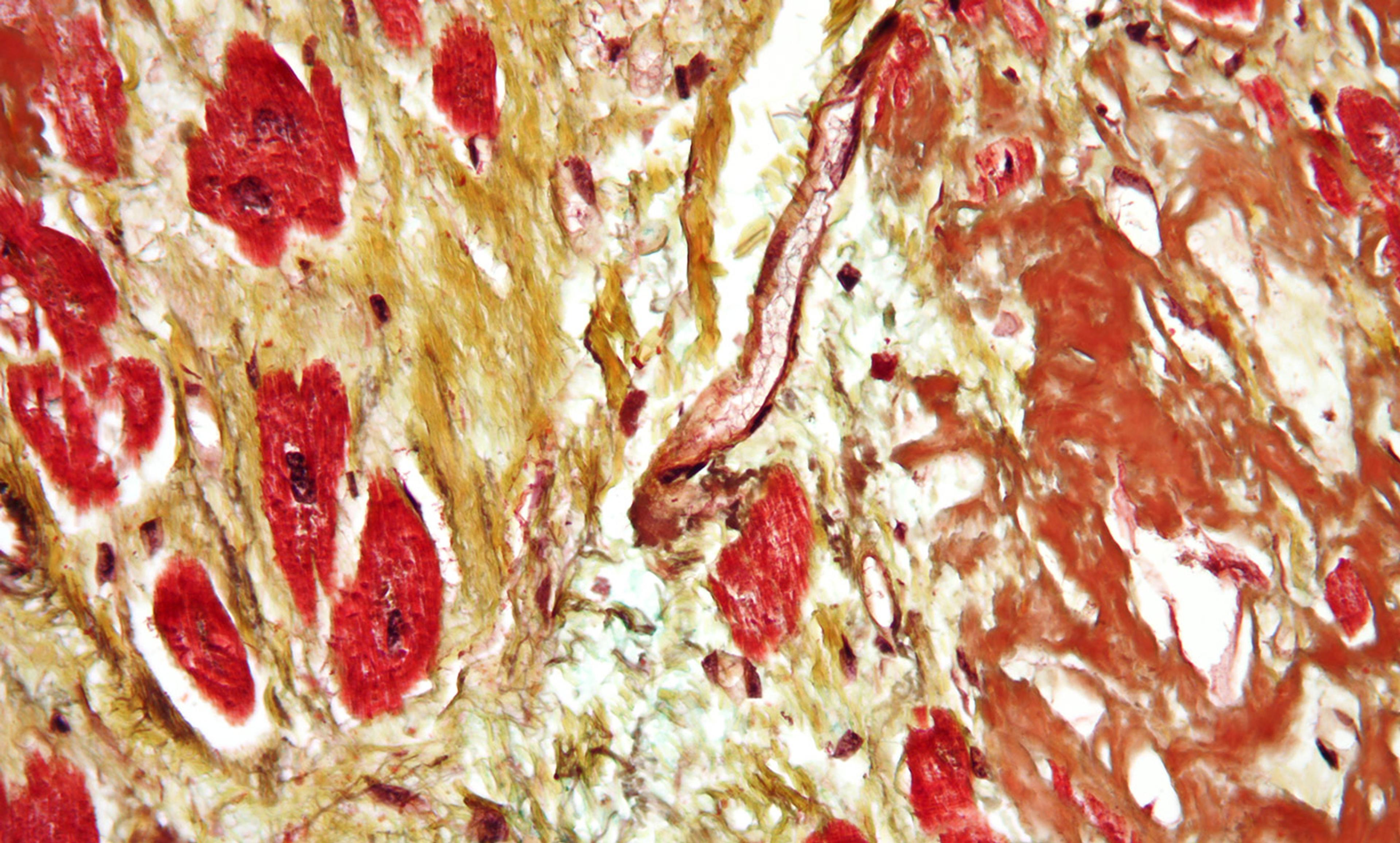 Microscopic photo of cardiac muscle tissue stained in red and yellow displaying muscle fibres, nuclei, and connective tissue details.