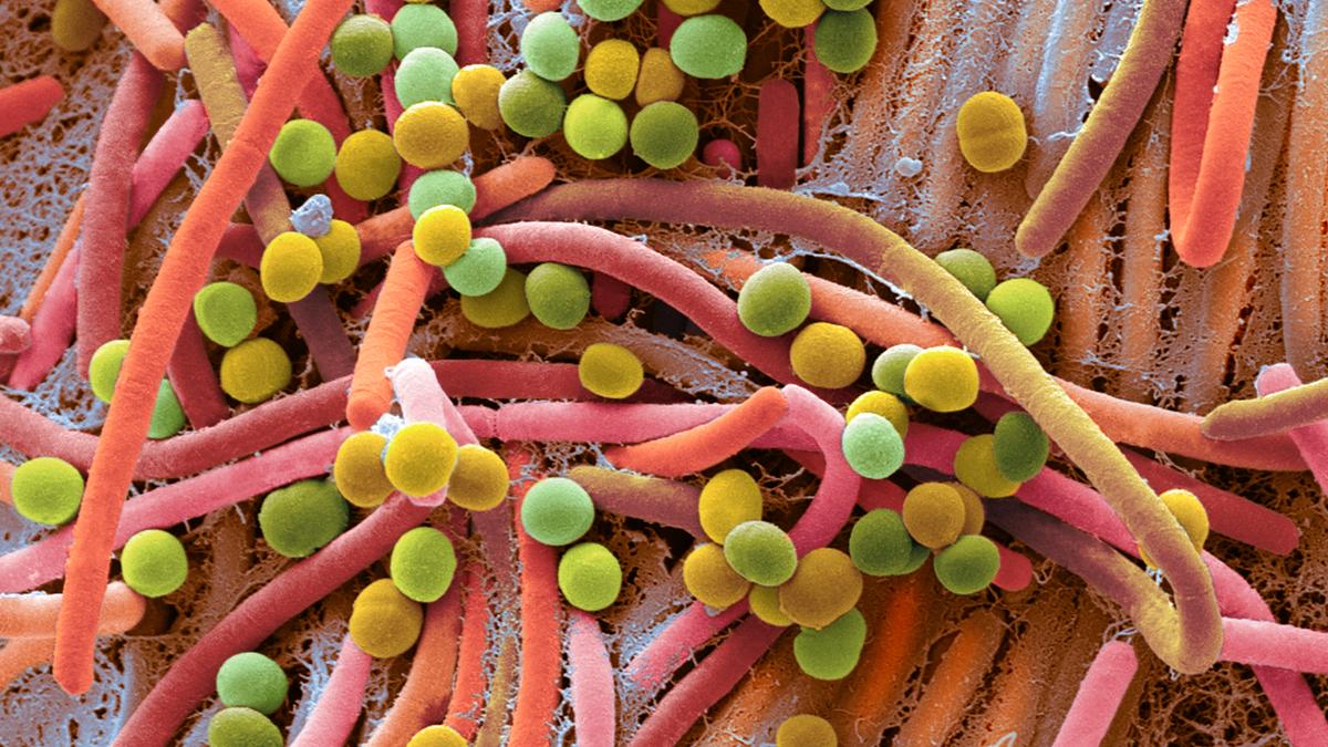 How to maintain a healthy gut How to maintain a healthy gut