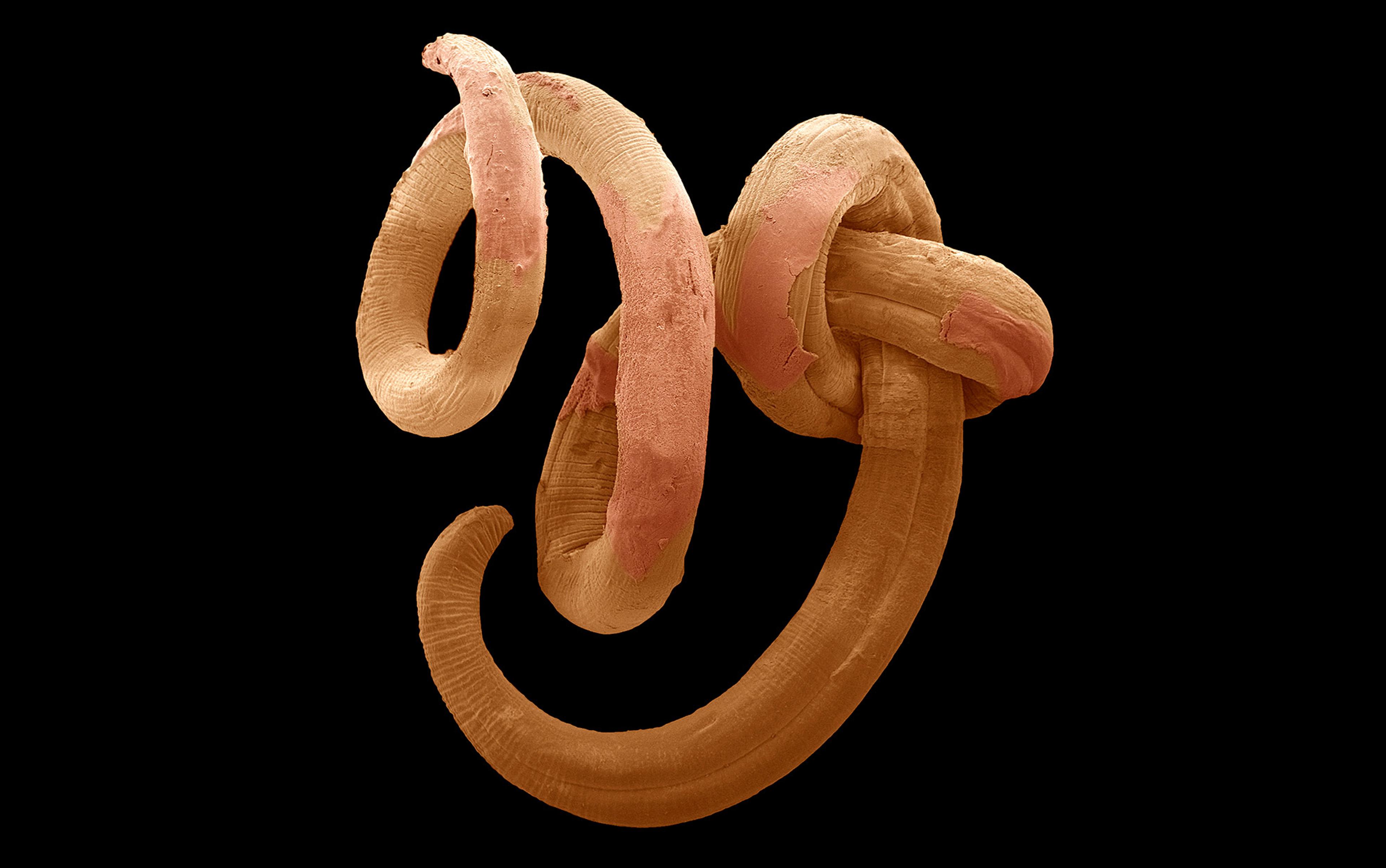 Gut worms were once a cause of disease, now they are a cure