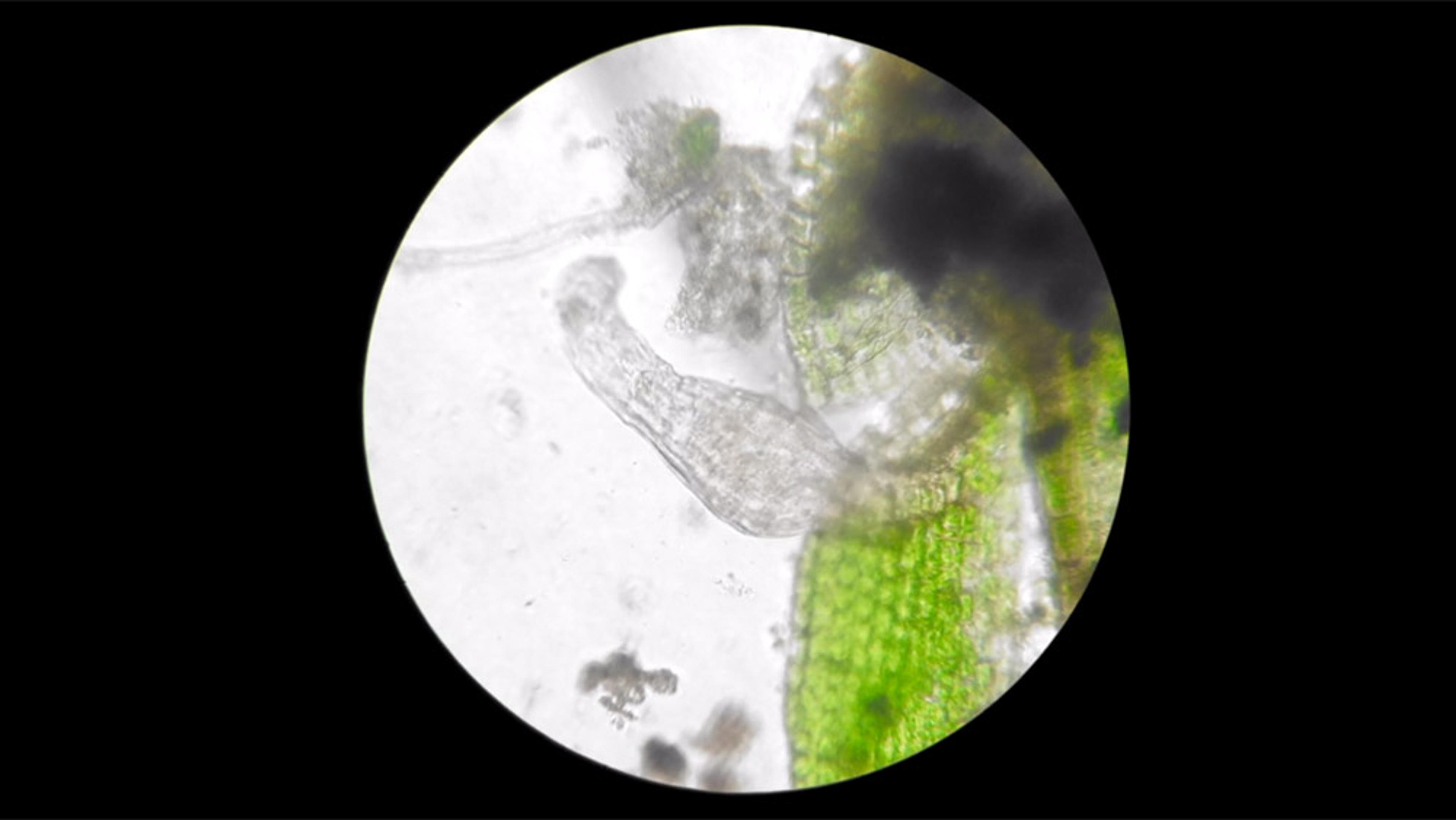 Microscopic photo of plant cells and a nematode viewed through a microscope with green chloroplasts and dark structures visible.