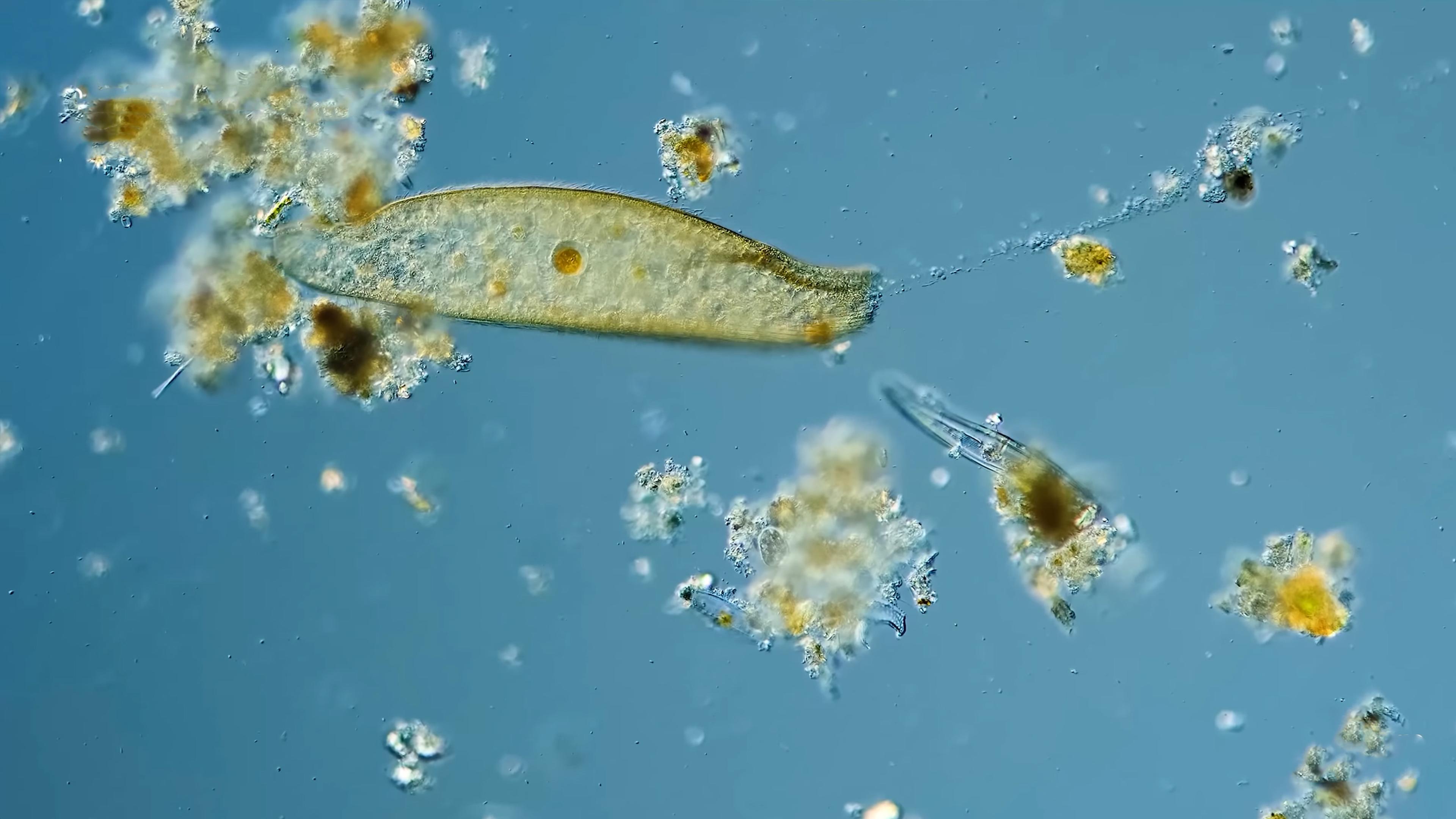 Microscopic view of various microorganisms and particles in a blue liquid, showing a large oval-shaped microorganism amidst smaller particles.