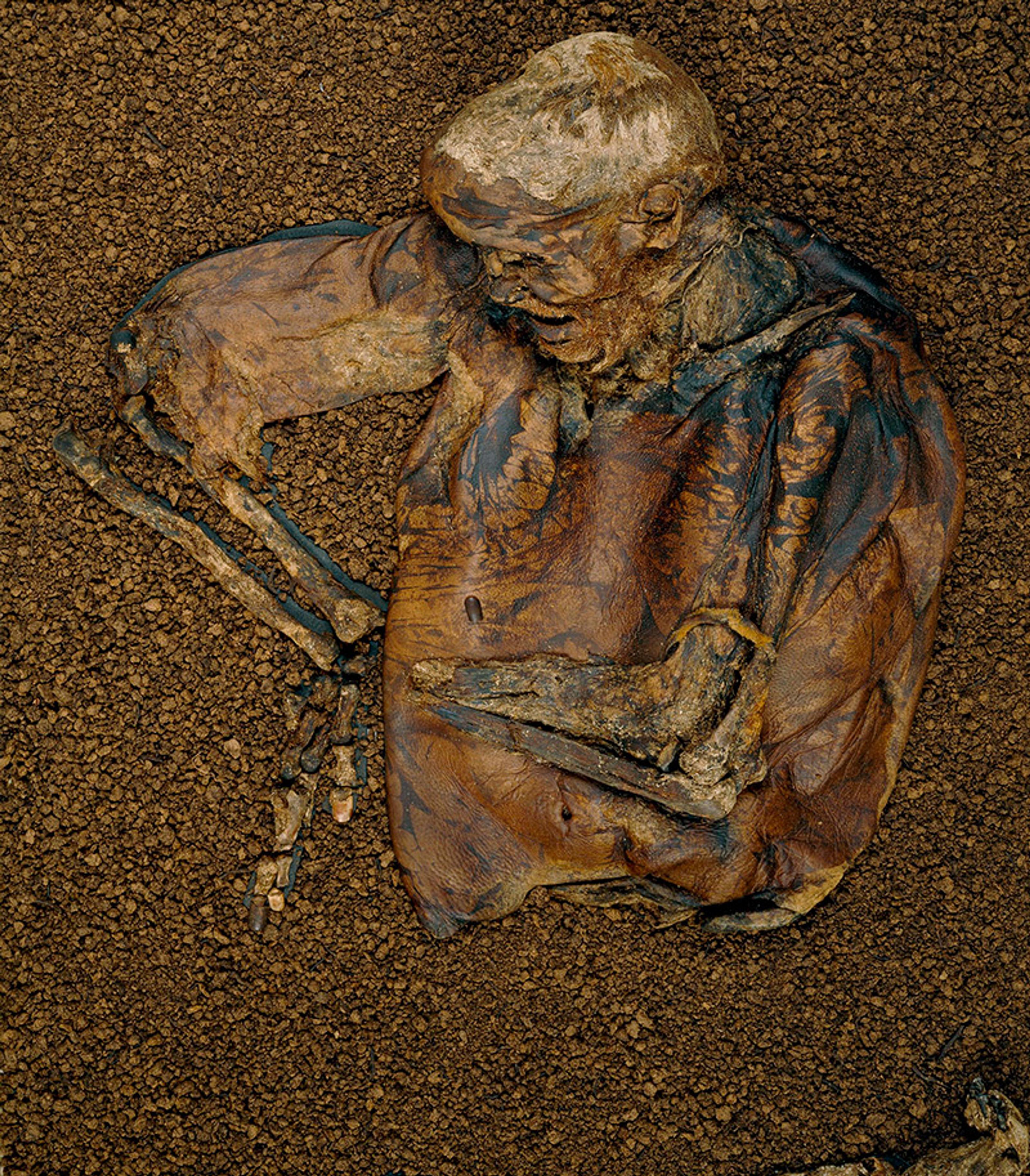 A well-preserved bog body with detailed skin and bones partially covered in soil, showing an ancient human figure.