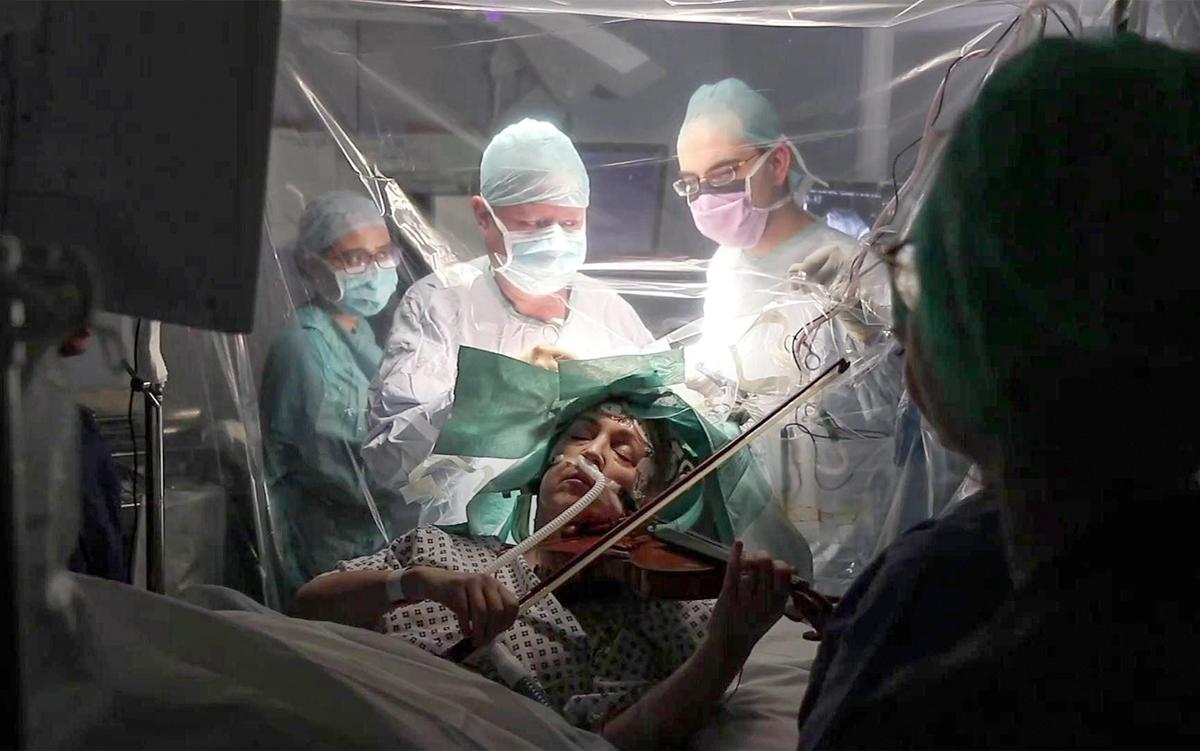 A patient plays the violin while undergoing brain surgery, surrounded by surgeons and medical staff wearing scrubs and masks in an operating theatre.