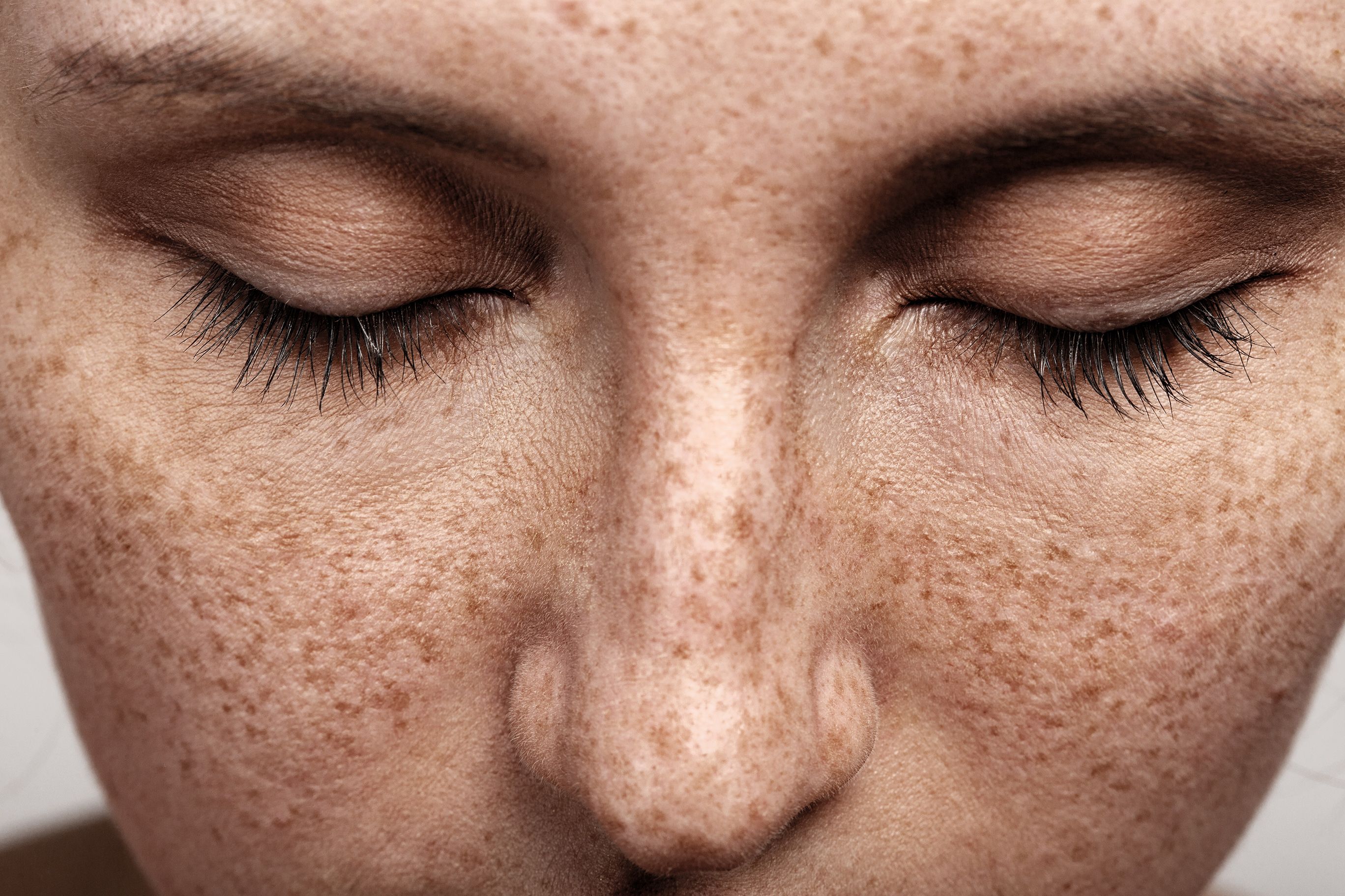 Close-up photo of a person’s face with closed eyes and freckles on their skin.