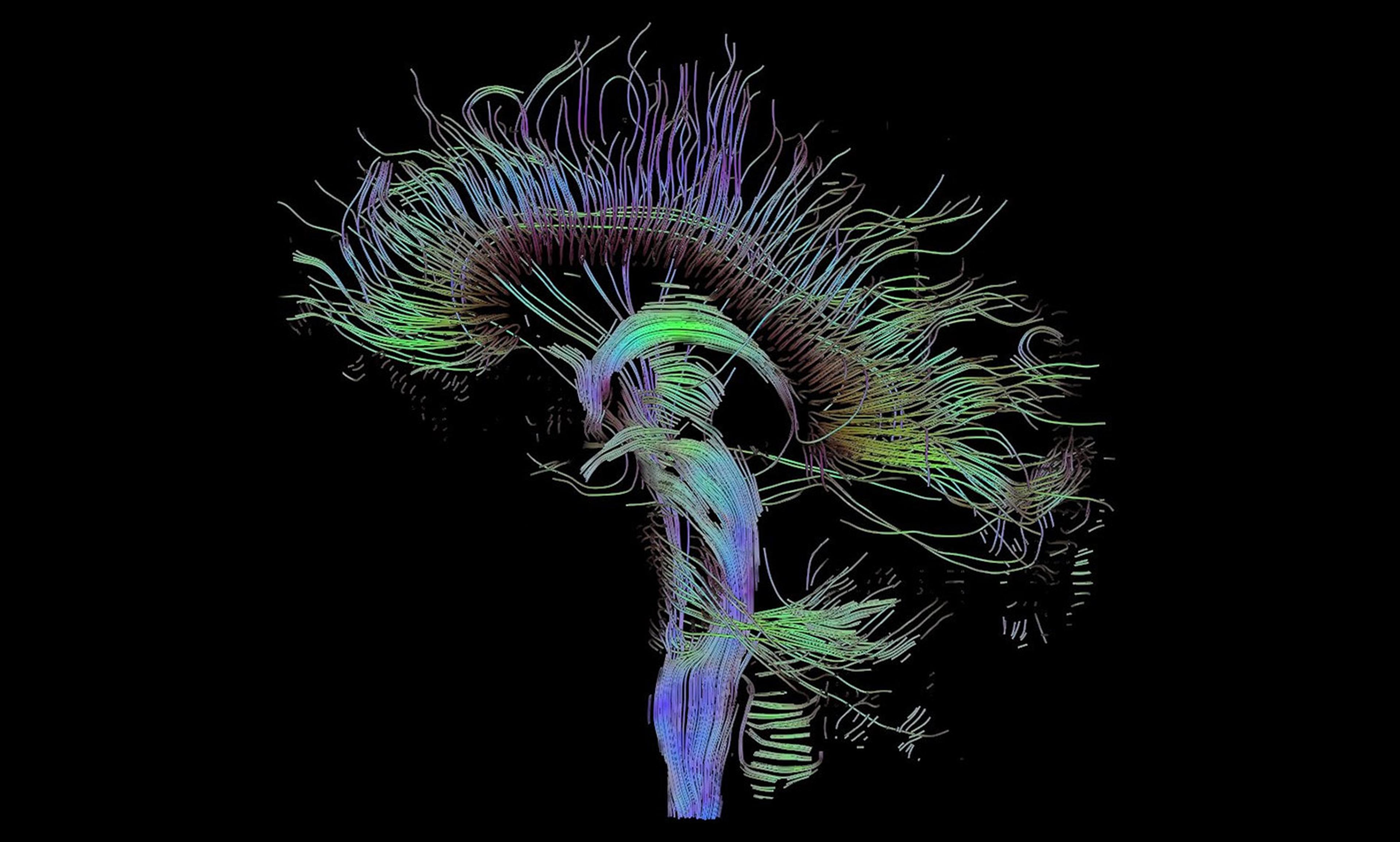 <p>Neural pathways in the brain. <em>Photo courtesy Wikipedia</em></p>