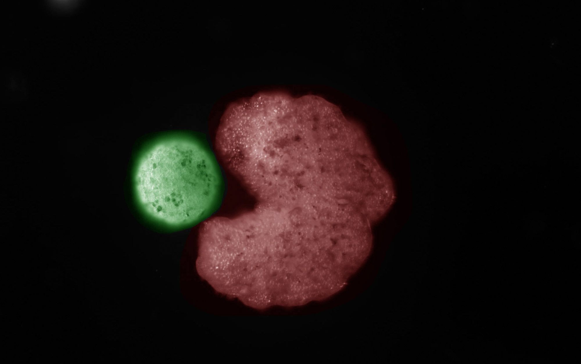 How a shape-shifting receptor influences cell growth
