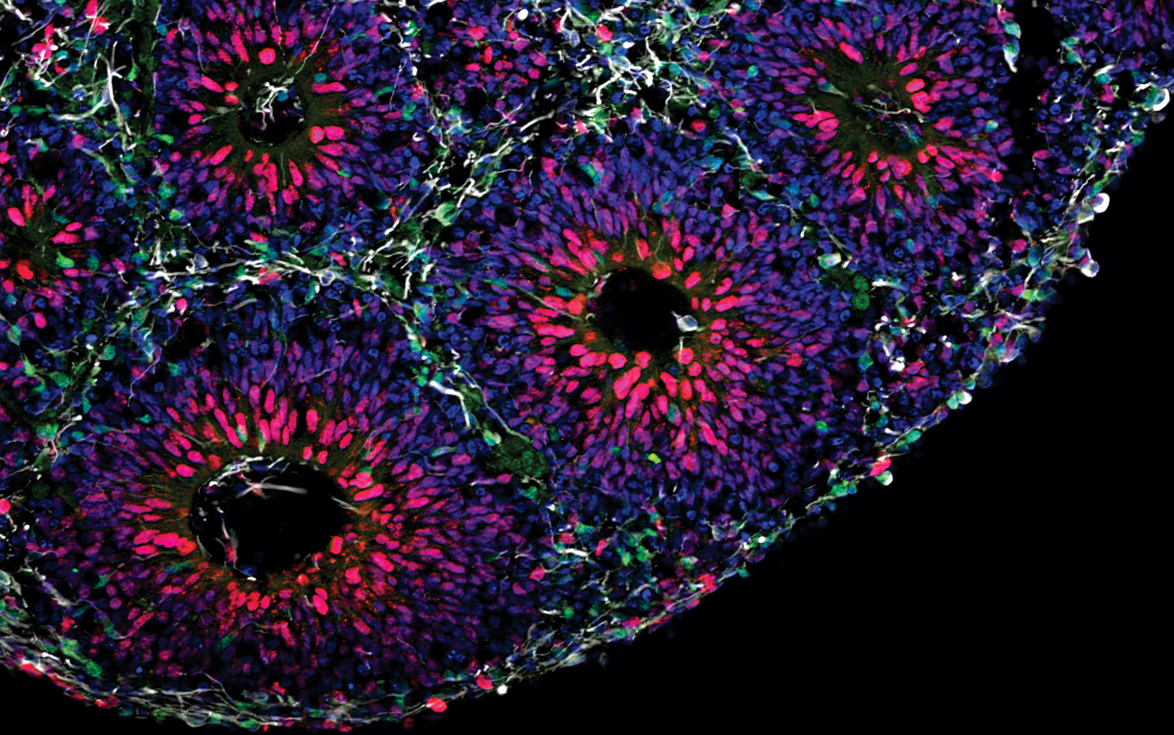 Microscopic image of colourful neural tissue with bright pink, green and blue cells, showing intricate patterns.