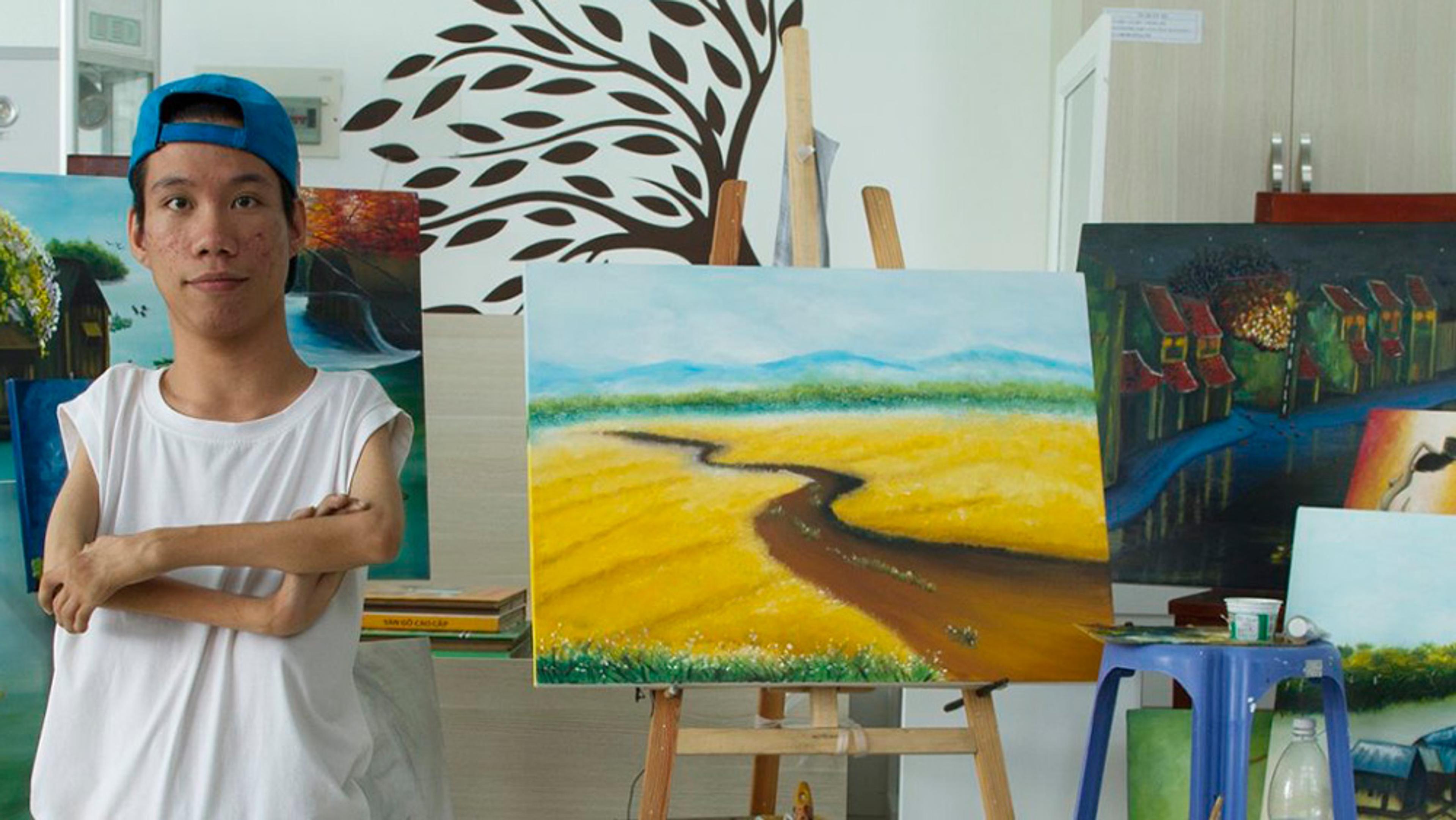 A man with deformed limbs in an art studio, standing by paintings on easels including a river landscape and a night scene.