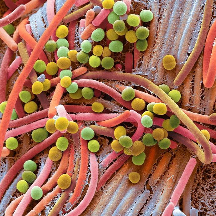 Coloured microscopic image of pollen grains and plant fibres in close-up, showing vibrant round and elongated structures.