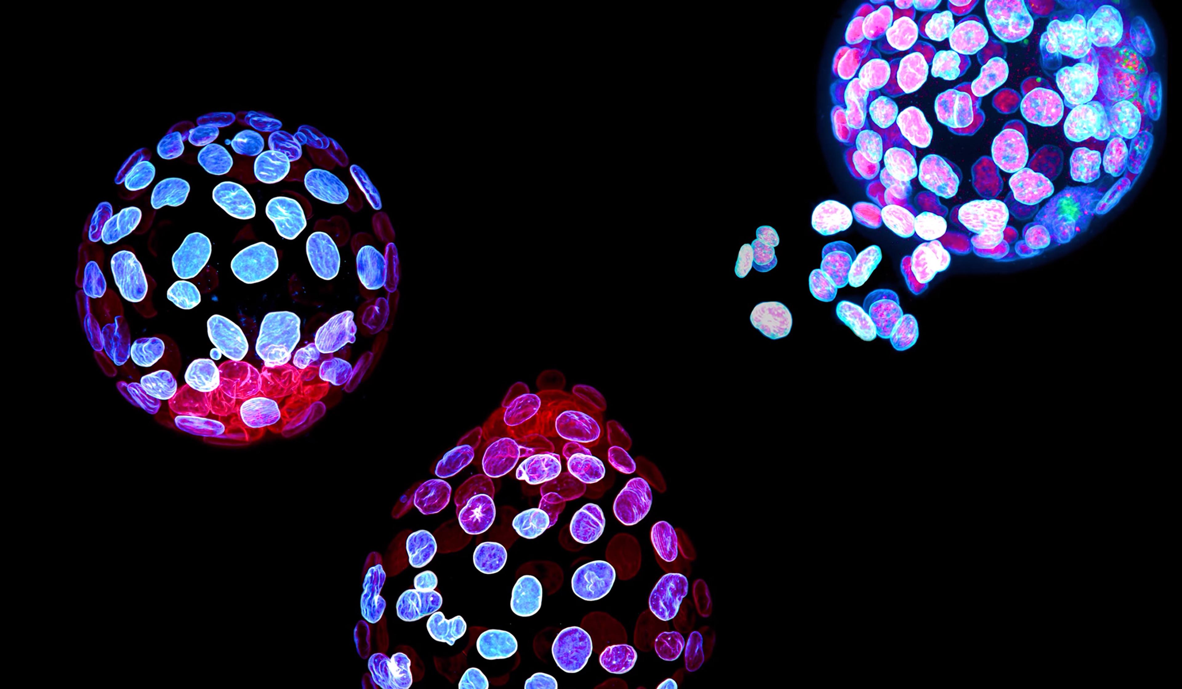 Three colourful cell spheres with glowing pink and blue nuclei on a black background, showing cellular structures in vibrant detail.