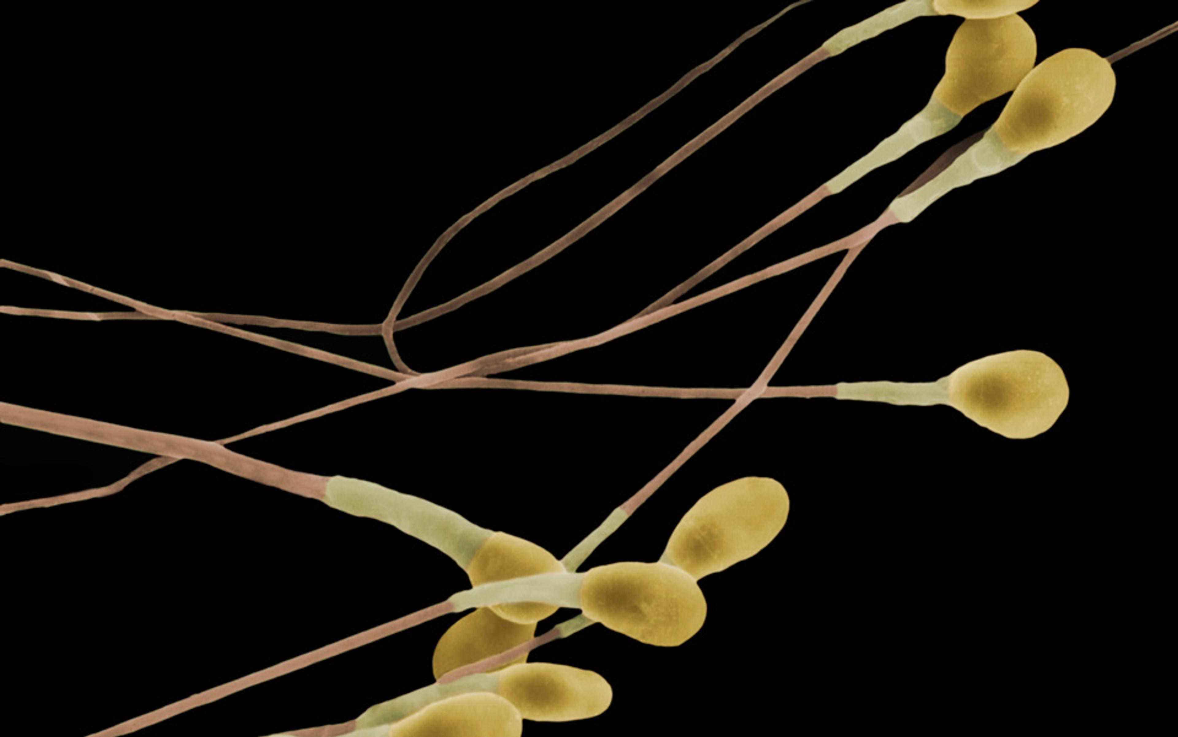Microscope image of yellow sperm cells with long tails on a black background.