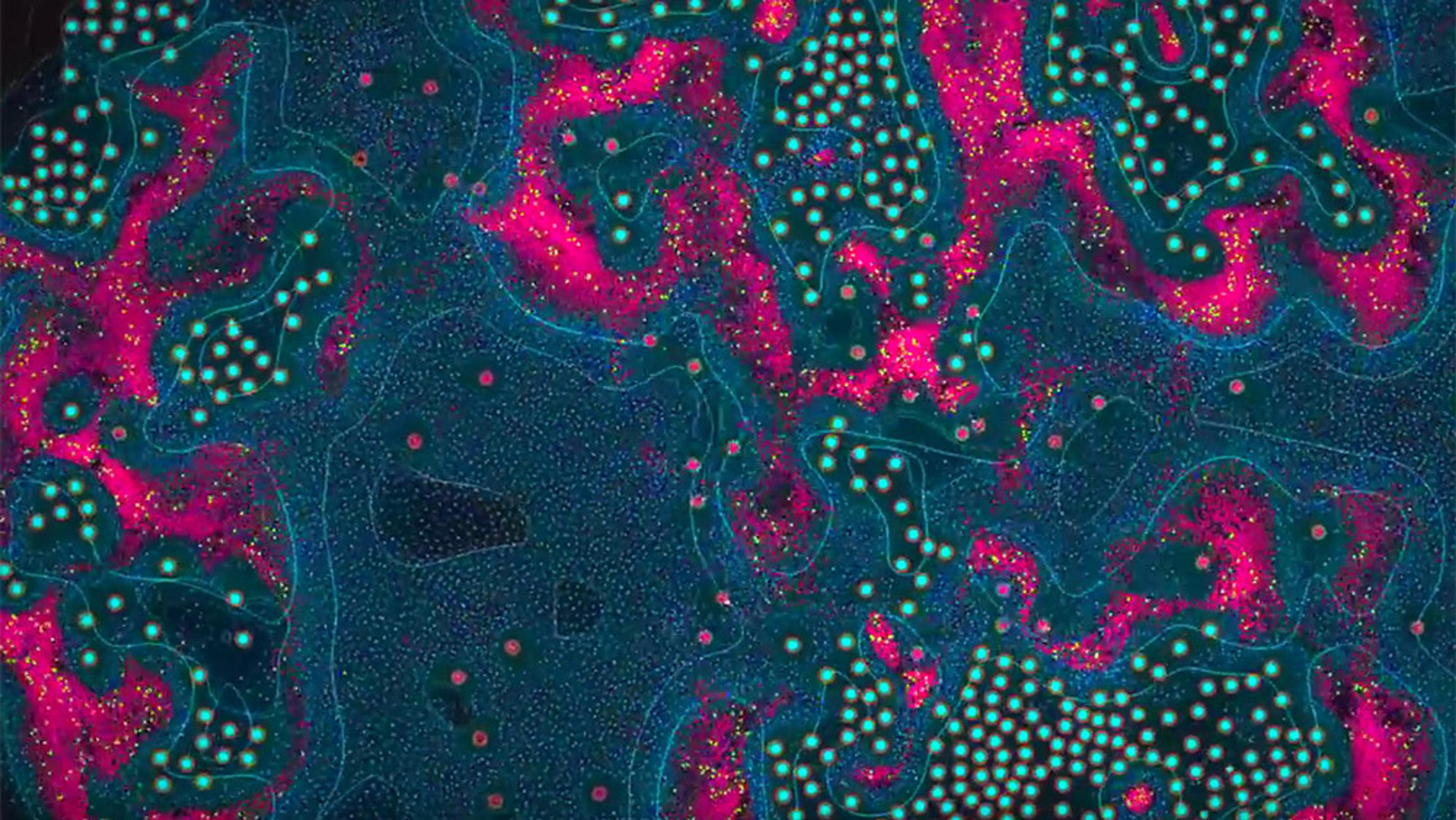 Abstract painting with bright pink, turquoise and dark blue colours forming intricate patterns and clusters across the canvas.