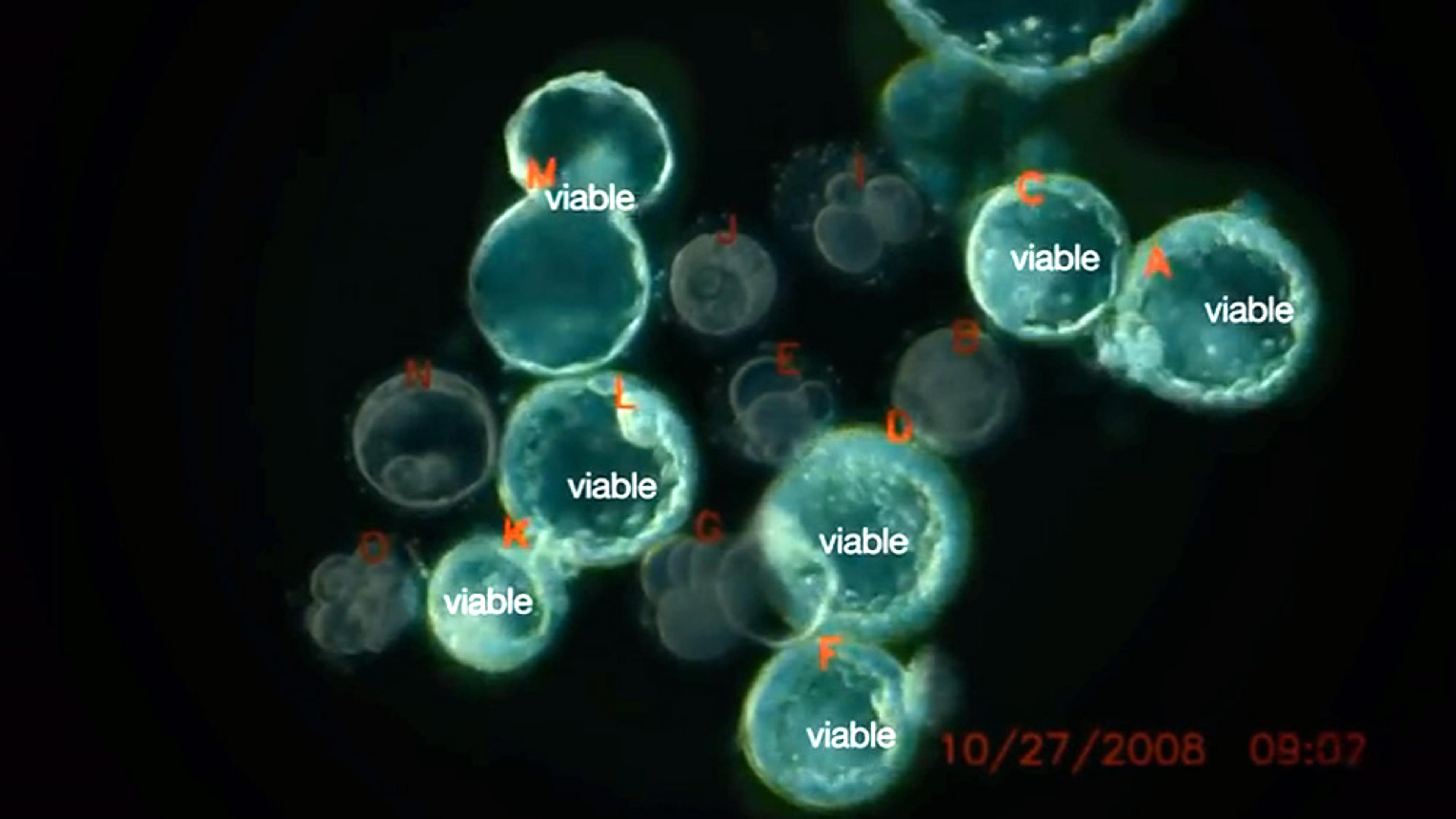 Microscopic cells labelled with “viable” and various letters. Date stamped 27/10/2008, time 09:07.