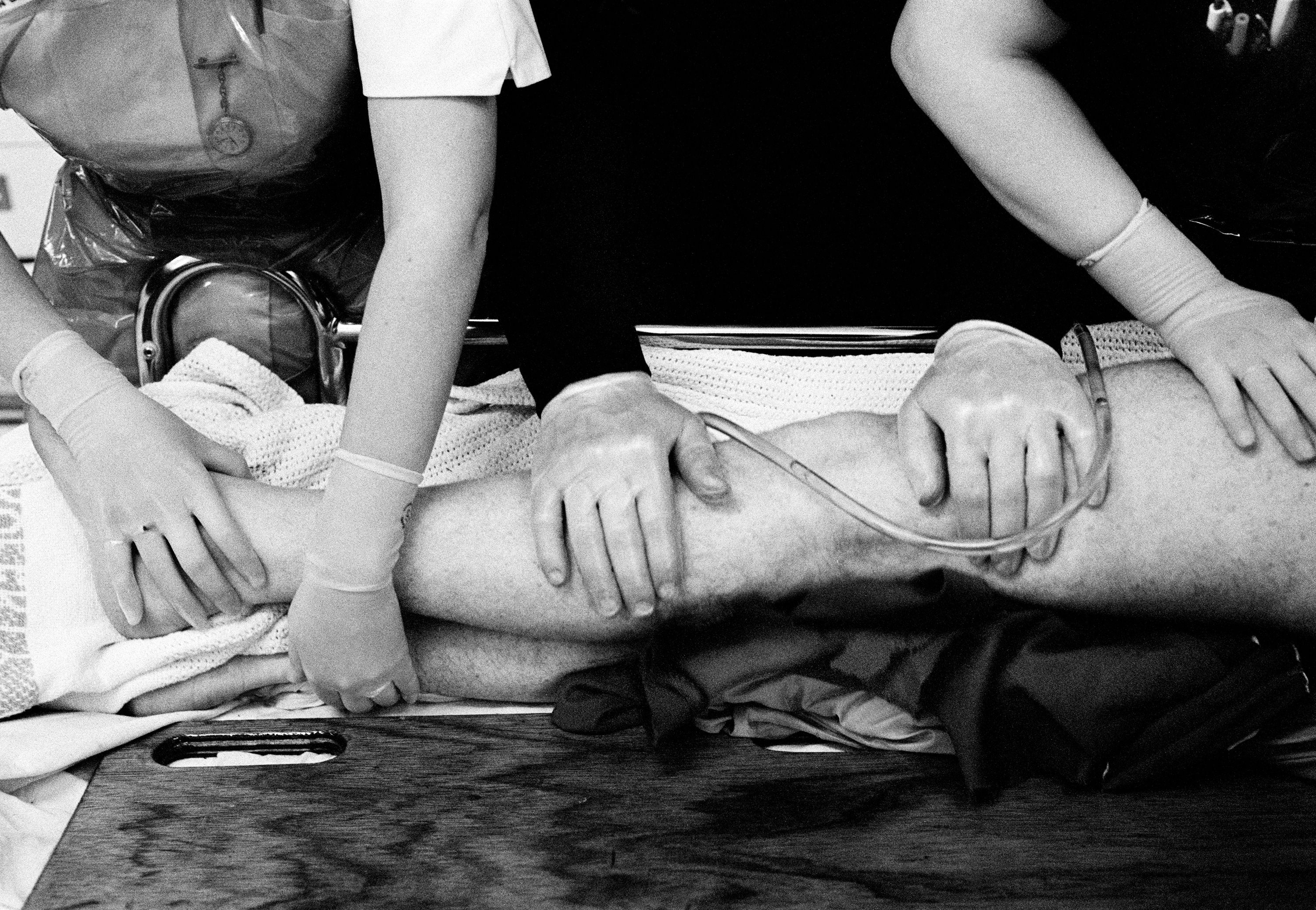 Black and white photo of medical staff handling a patient’s leg wearing gloves, an intravenous line is visible.