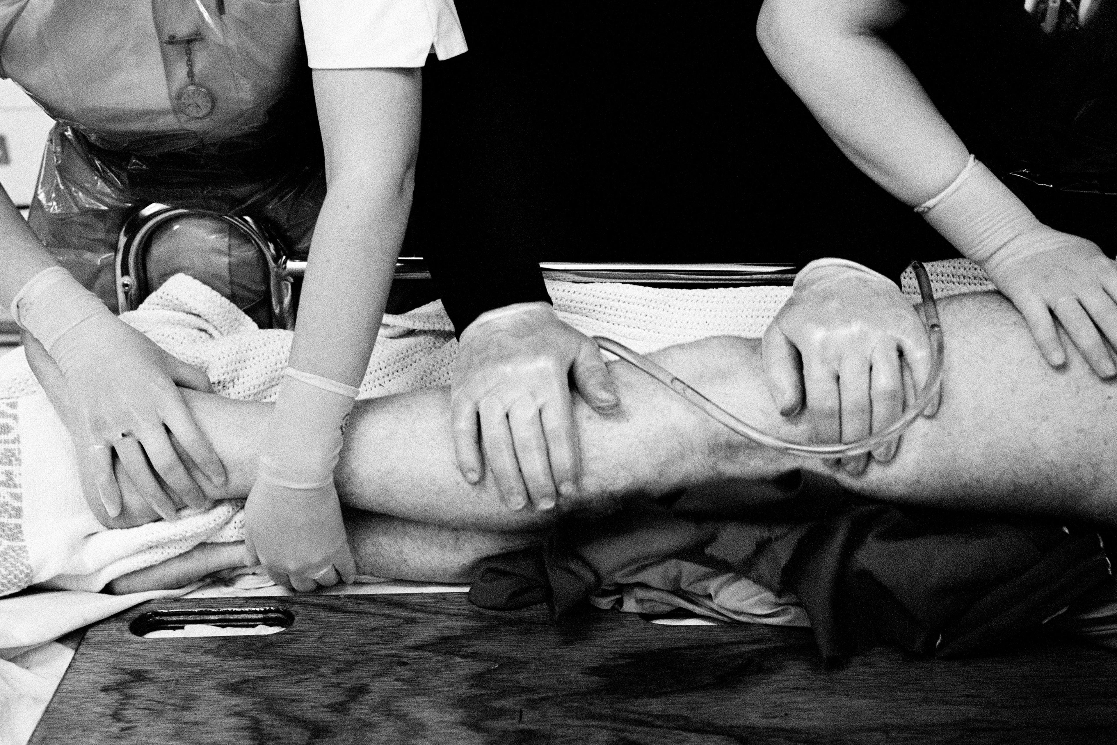 Black and white photo of medical staff handling a patient’s leg wearing gloves, an intravenous line is visible.
