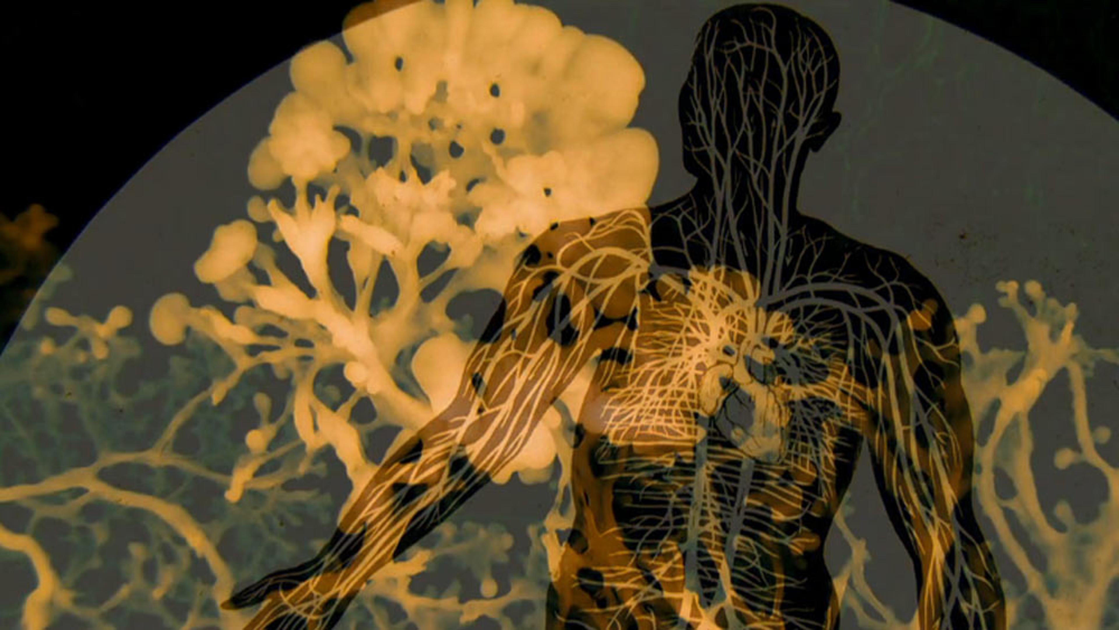 Illustration of a human silhouette overlaid with neural network pathways and abstract shapes, highlighting the nervous system’s complexity.