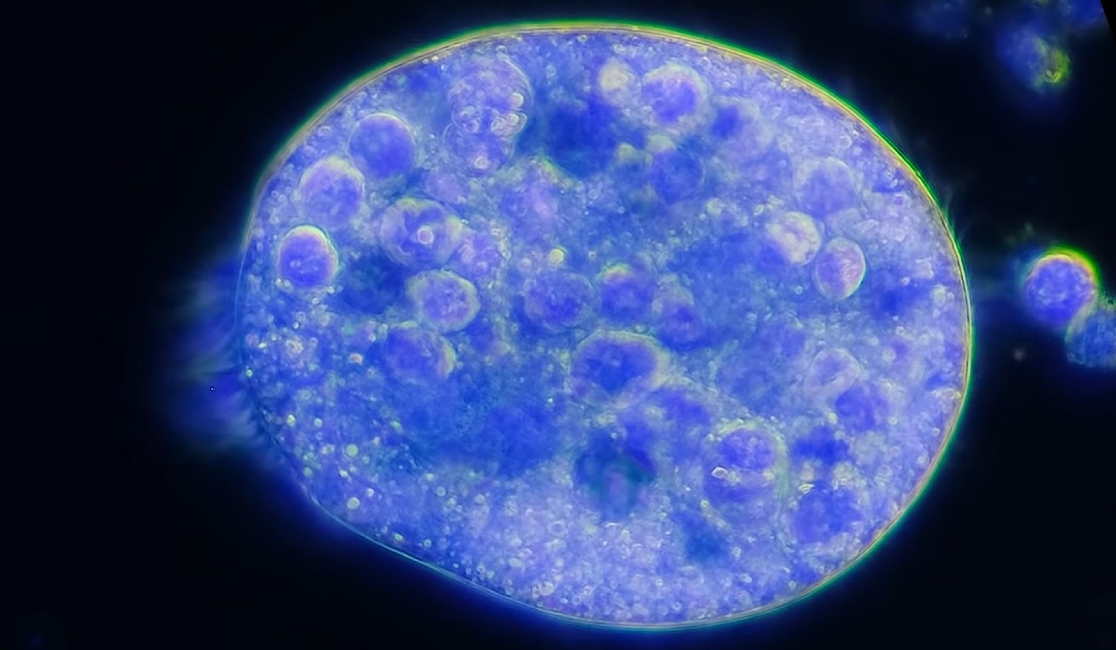 Microscopic photo of a single cell with a blue hue and dark background showing detailed internal structures like organelles.