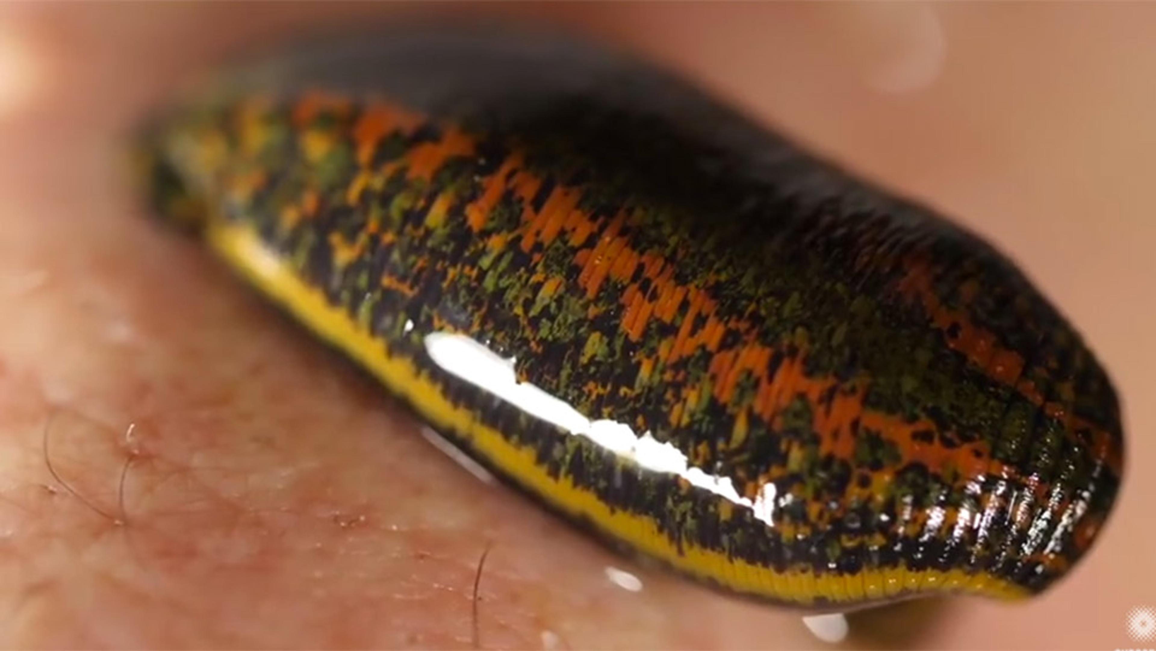 Once dismissed as quackery, medical leeches are back for blood