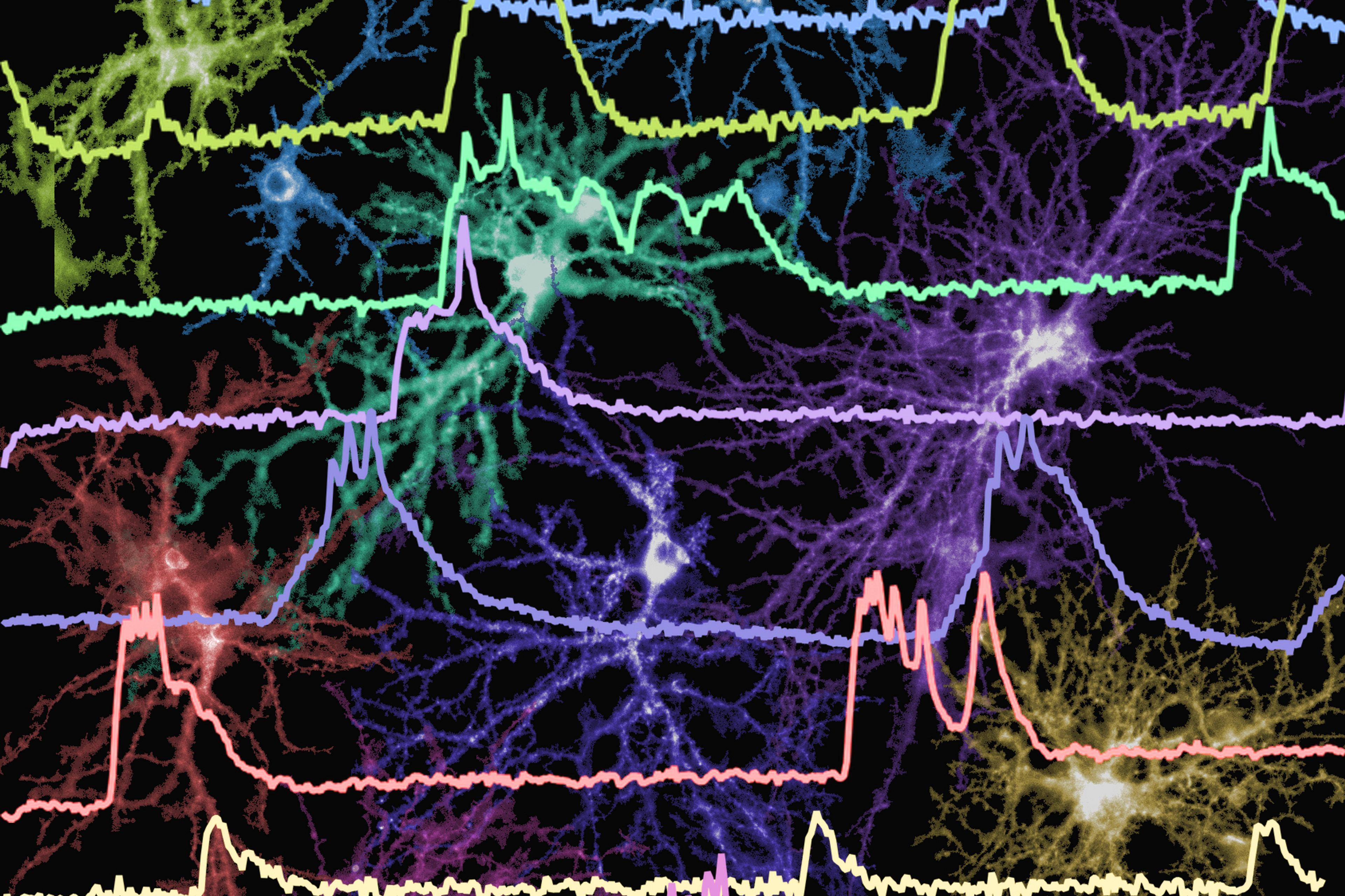 Colourful digital illustration of neuron activity overlaid with graph lines showing brainwave patterns on a black background.
