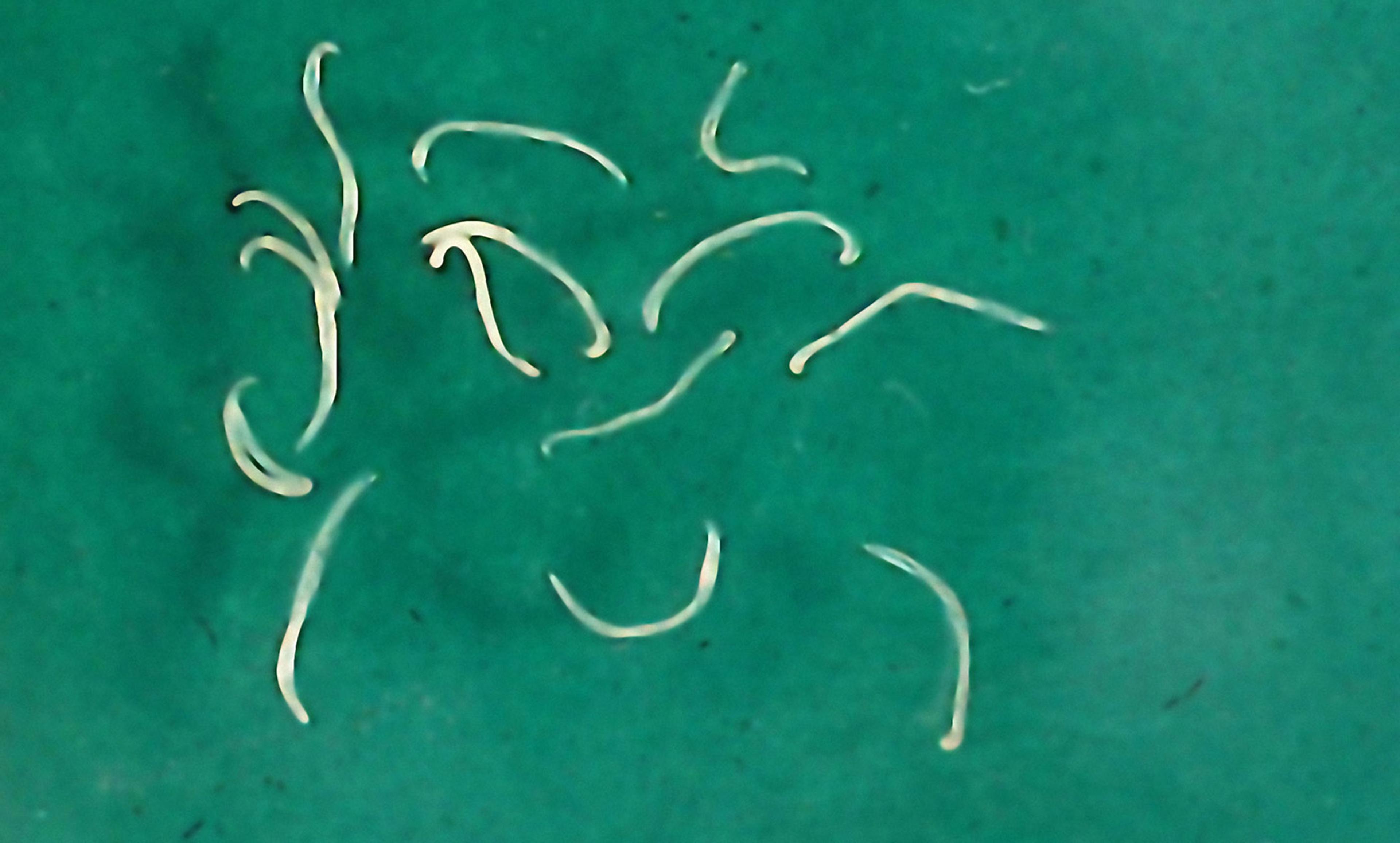 <p>Parasitic hookworms. <em> Photo by Getty</em></p>