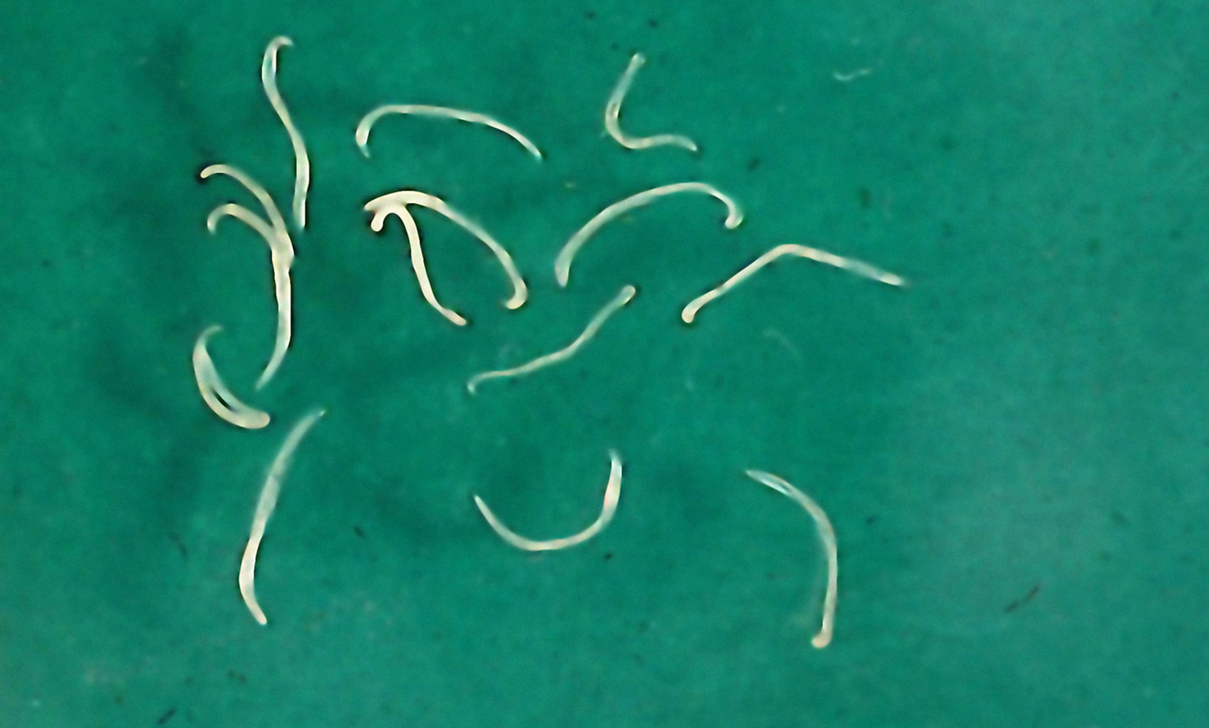 Several thin, white worms on a green surface. The worms are curved in various shapes and appear scattered randomly.