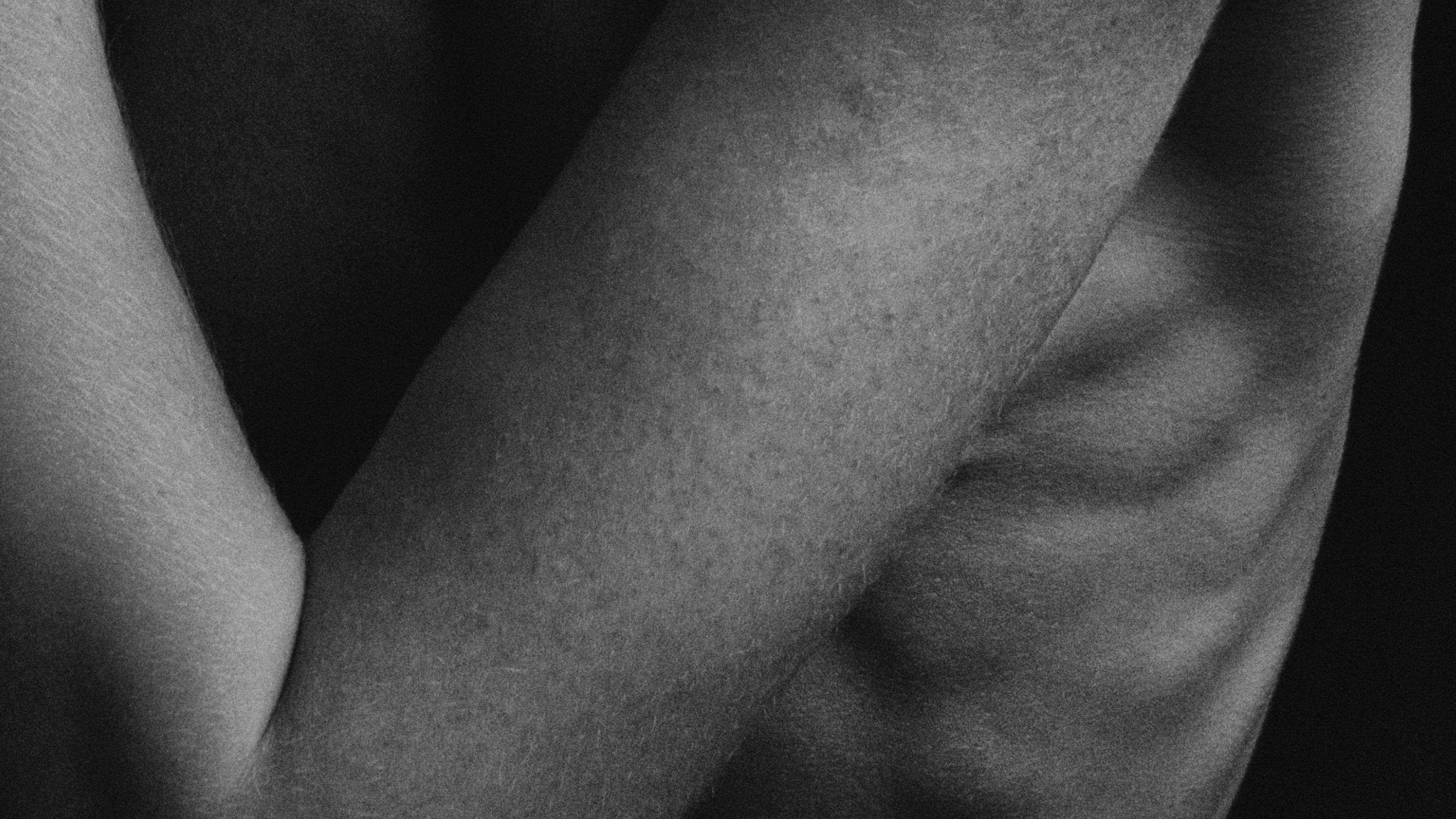 Black and white close-up photo of a person’s arm showing skin texture and pigment and shadows; protruding ribs are visible behind the arm.