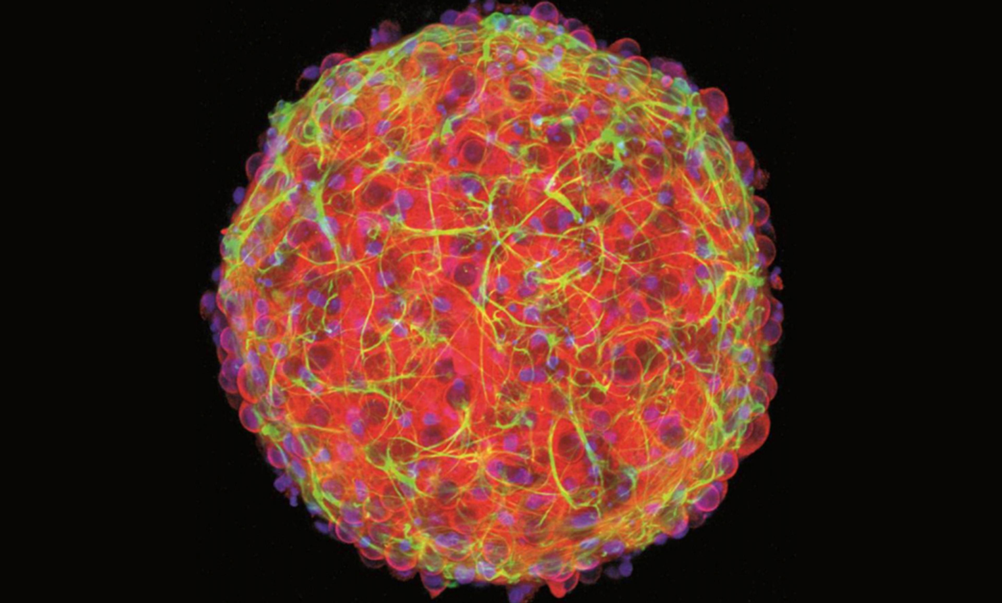 Microscopic image of a round neural organoid featuring bright red, green and purple colours on a black background.