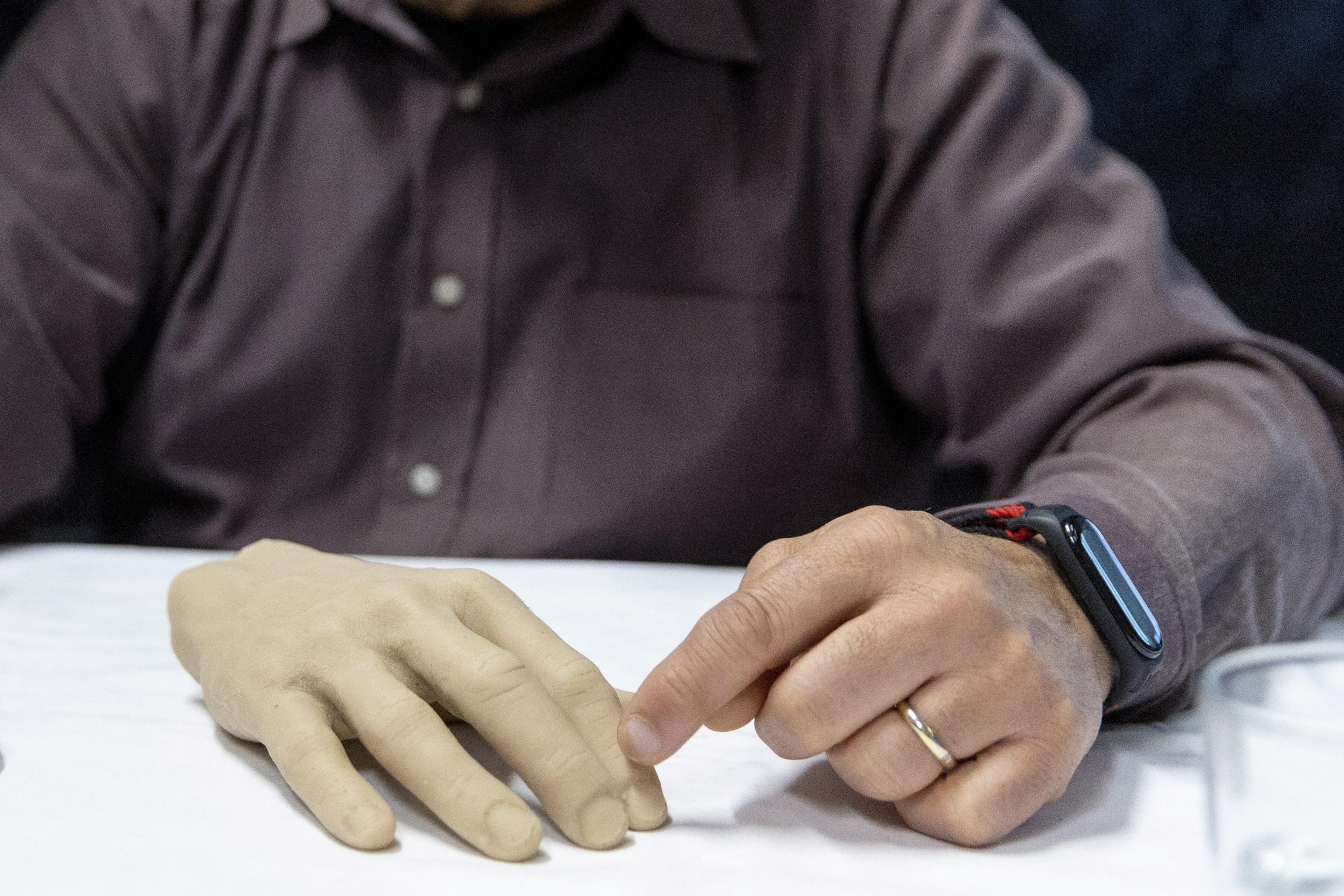 Photo of two men examining a prosthetic hand on a table, with wires and devices connected.