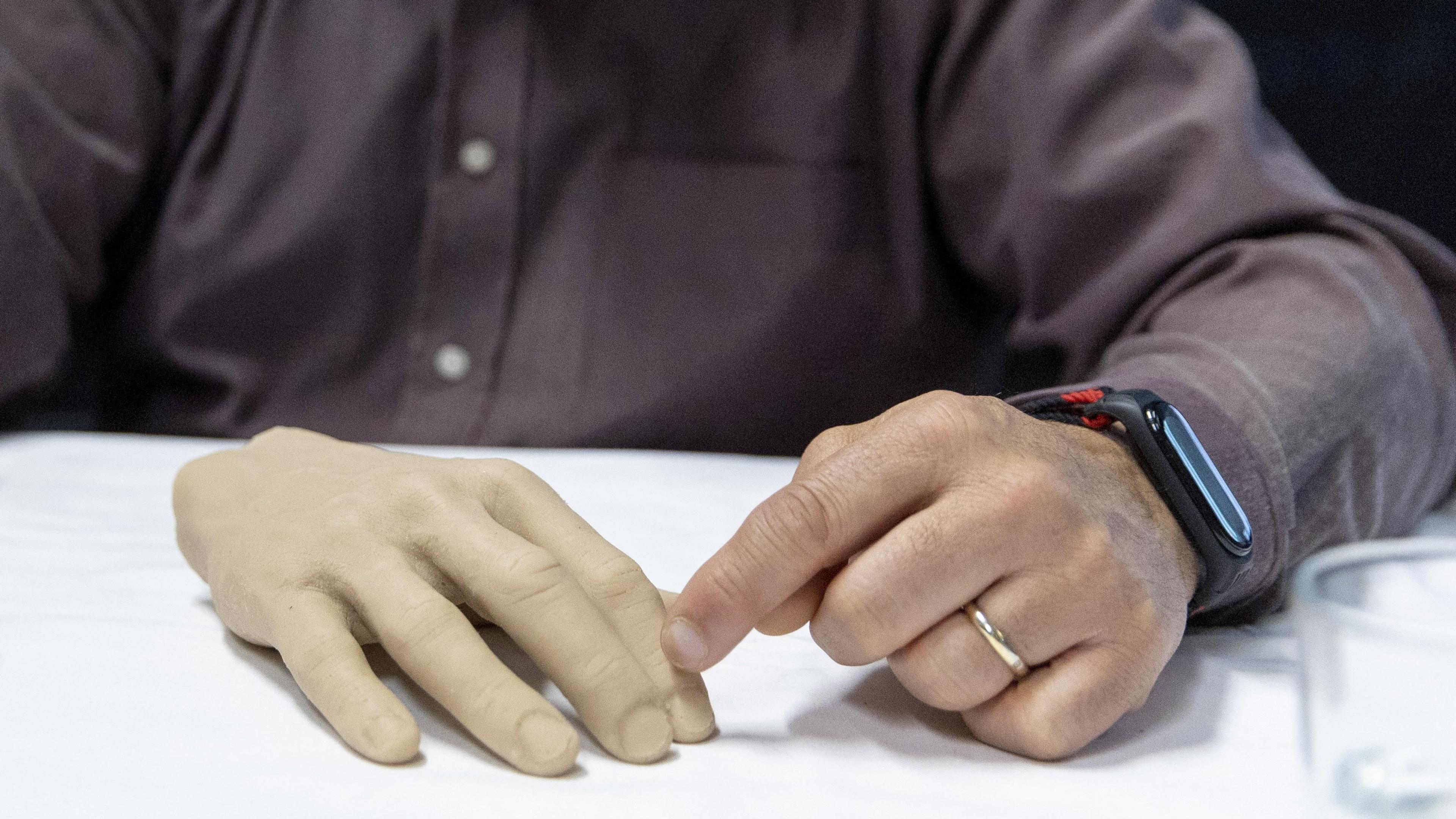 Photo of two men examining a prosthetic hand on a table, with wires and devices connected.