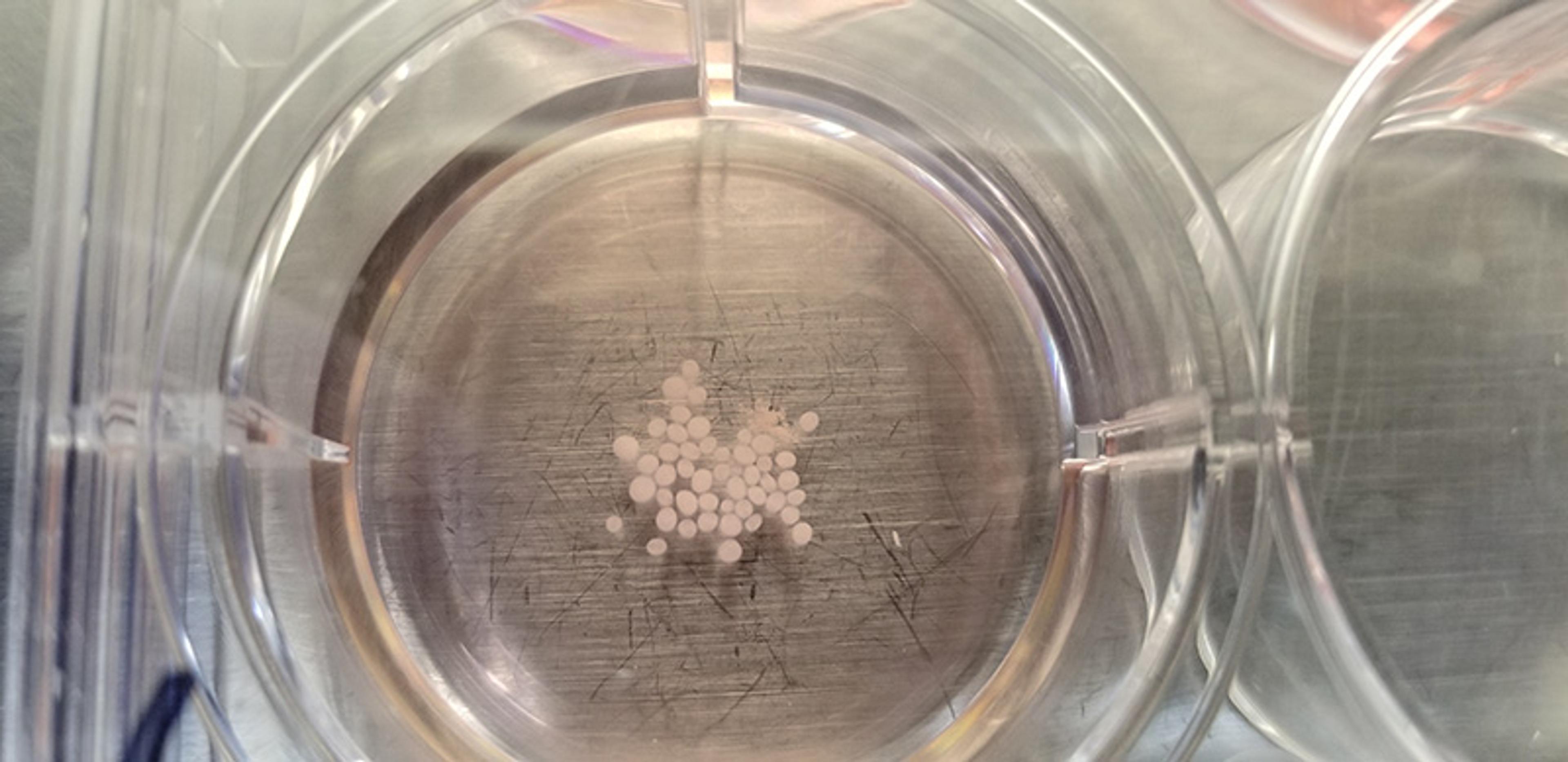 Small white pellets clustered in the centre of a round, clear plastic container placed on a scratched metallic surface.