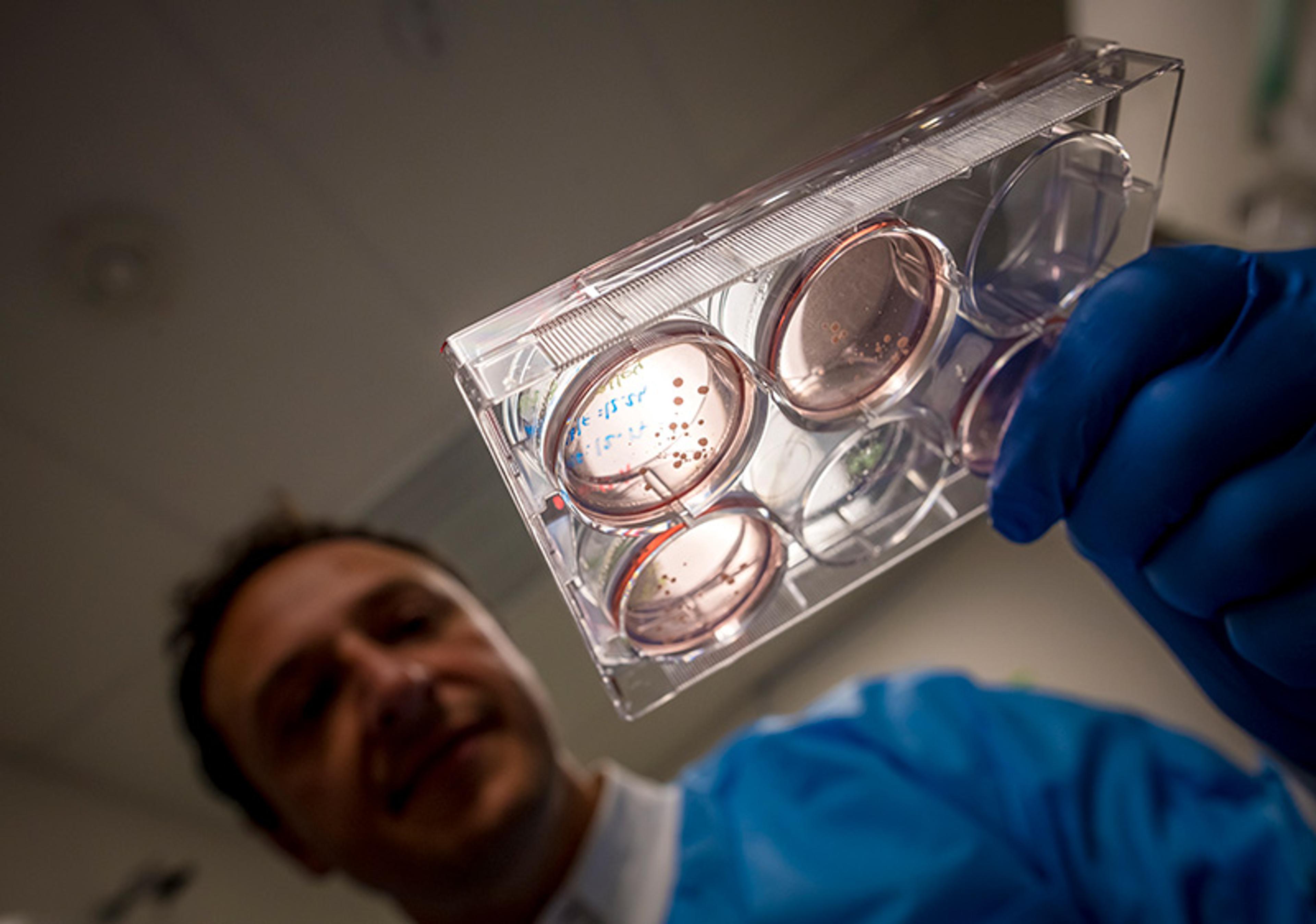 A scientist in a lab coat and blue gloves examines a petri dish with samples in a well plate.