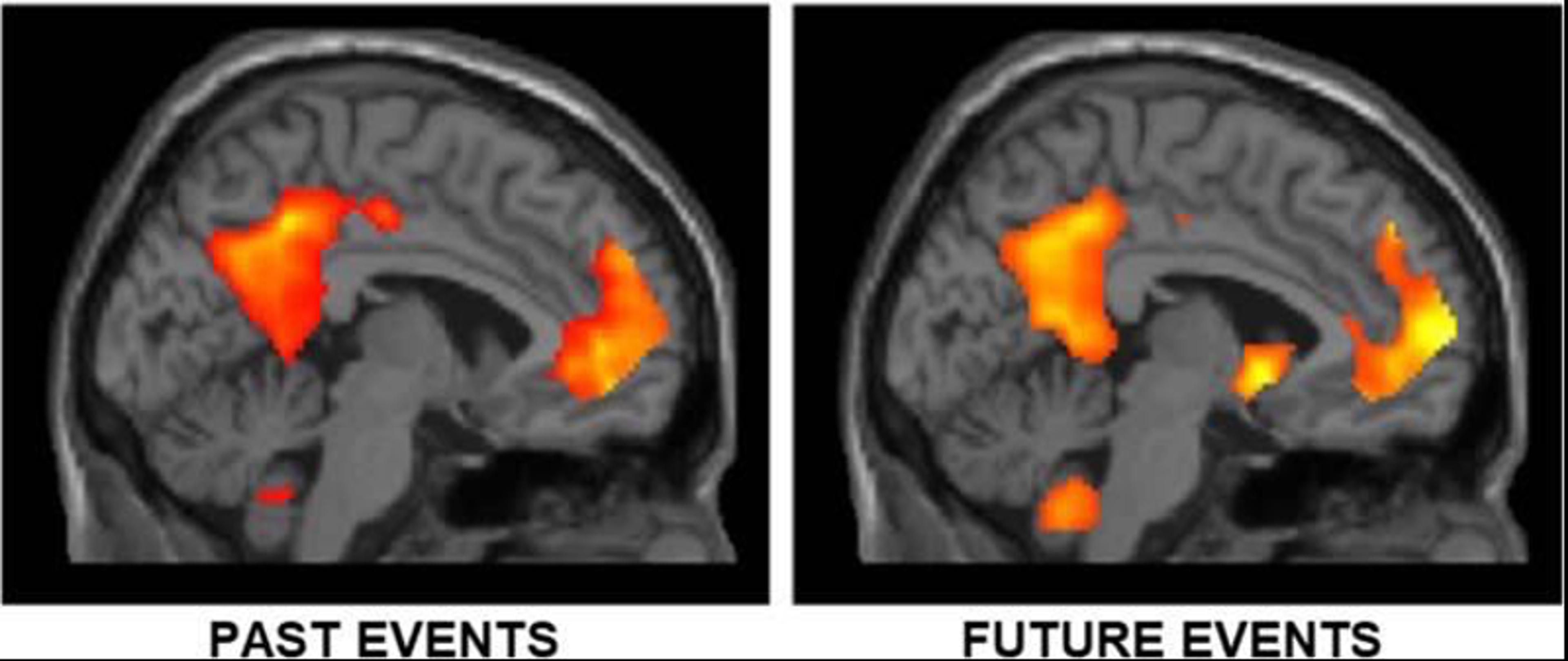 fMRI images showing brain activity: left is past events, right is future events, both with highlighted regions in red and yellow.