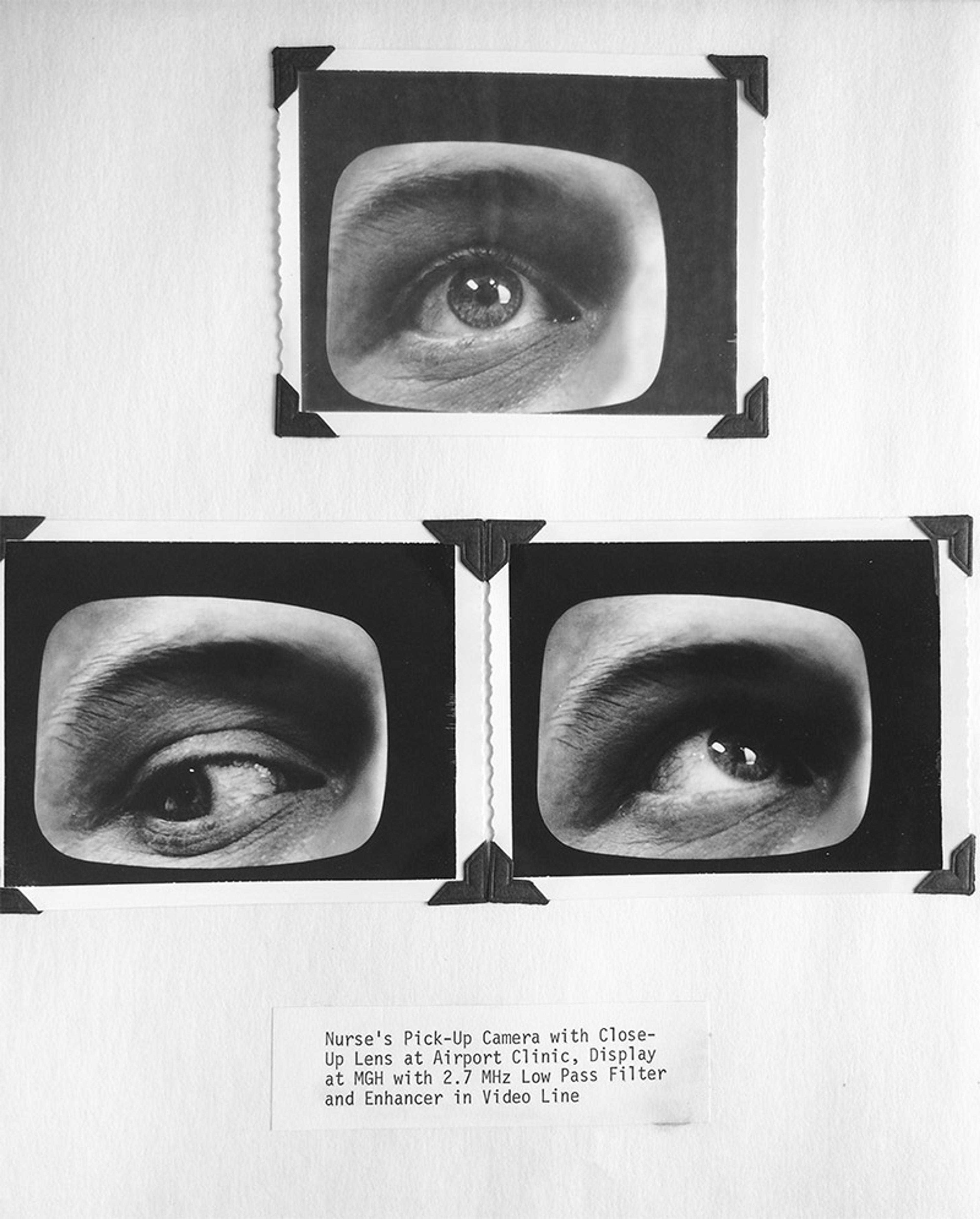 Three black-and-white photographs of an eye, framed at the corners, with a caption on the technique used.