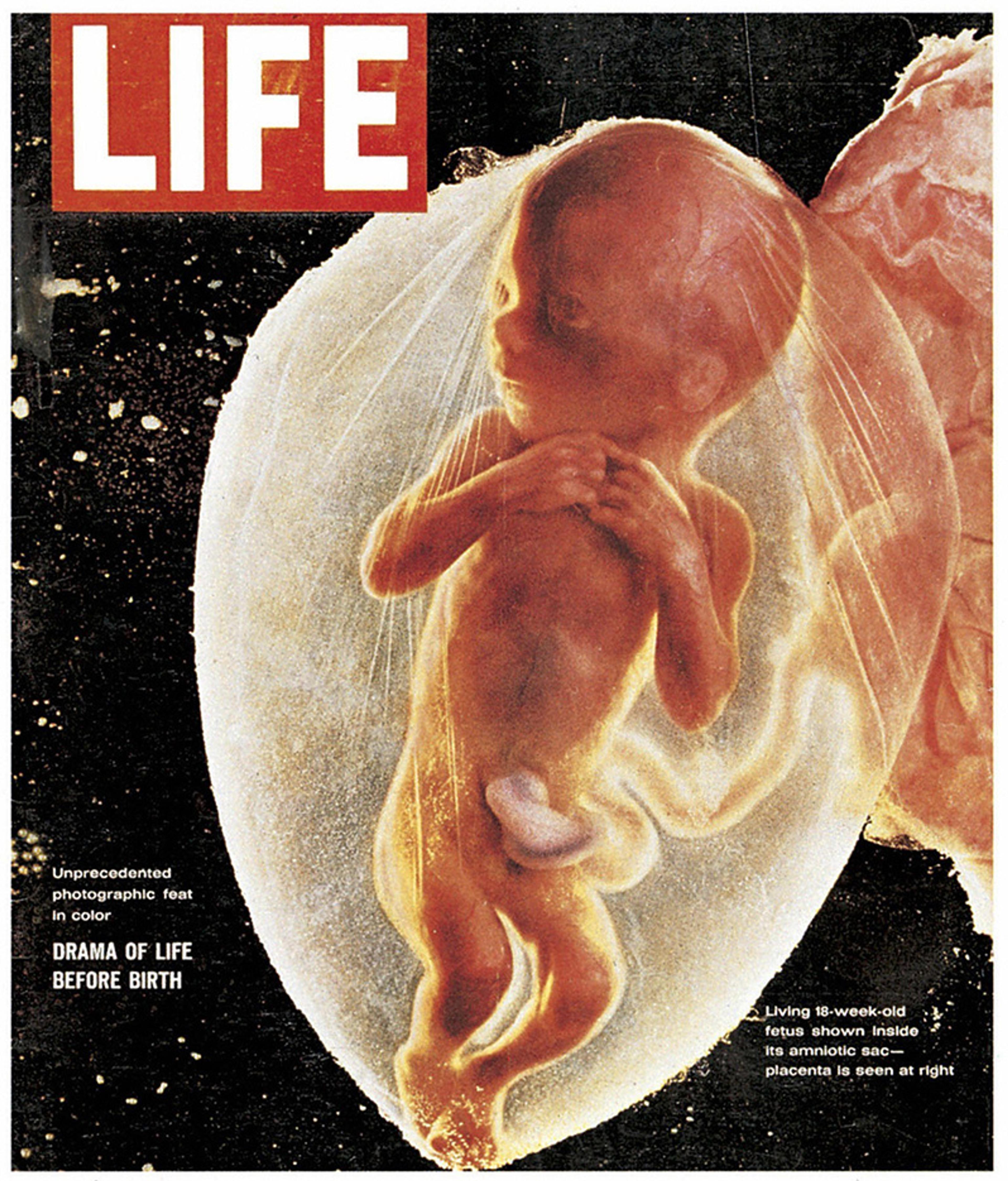 Cover of LIFE magazine showing an 18-week-old fetus in its amniotic sac. The image highlights the drama of life before birth, capturing this unprecedented photographic feat in colour. The text mentions “Unprecedented photographic feat in color” and “DRAMA OF LIFE BEFORE BIRTH.”