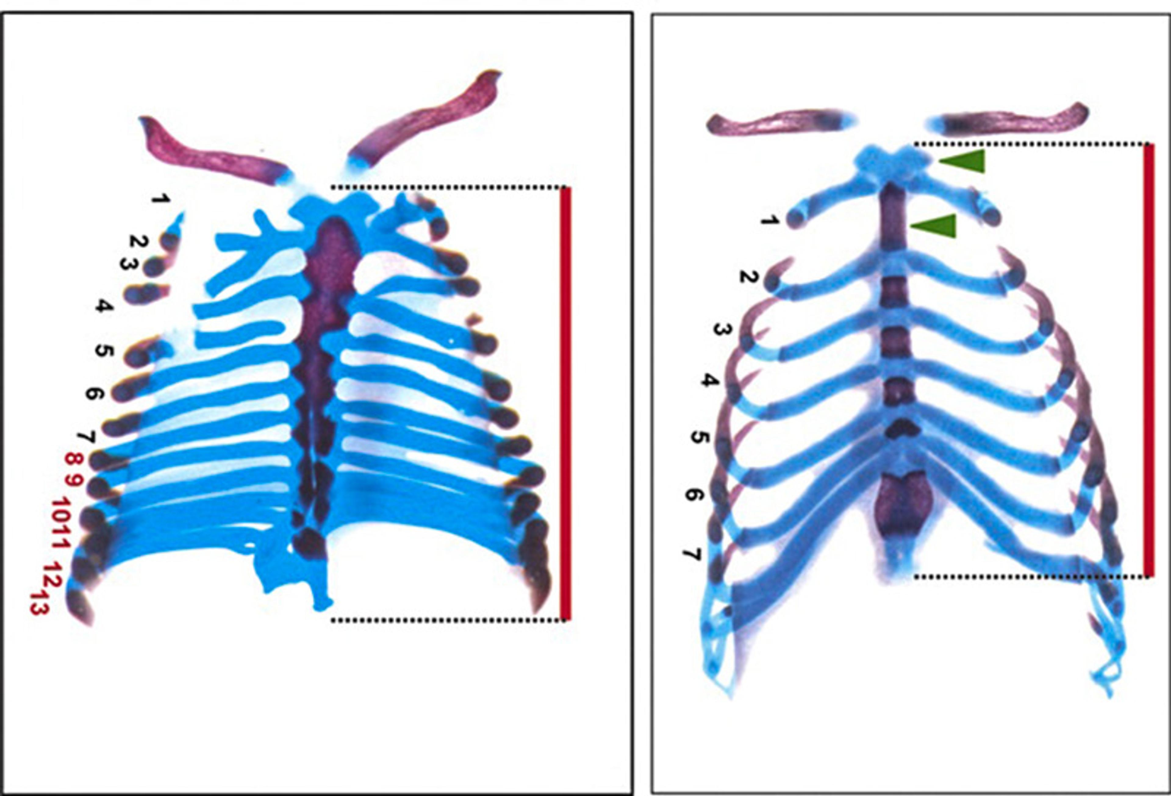 Side-by-side comparison of two coloured skeletal images showing differences in rib and vertebrae structure, with labels from 1 to 13 on the left and 1 to 7 on the right. The left image has more ribs and shows detailed vertebrae sections, while the right has fewer ribs and green markers.
