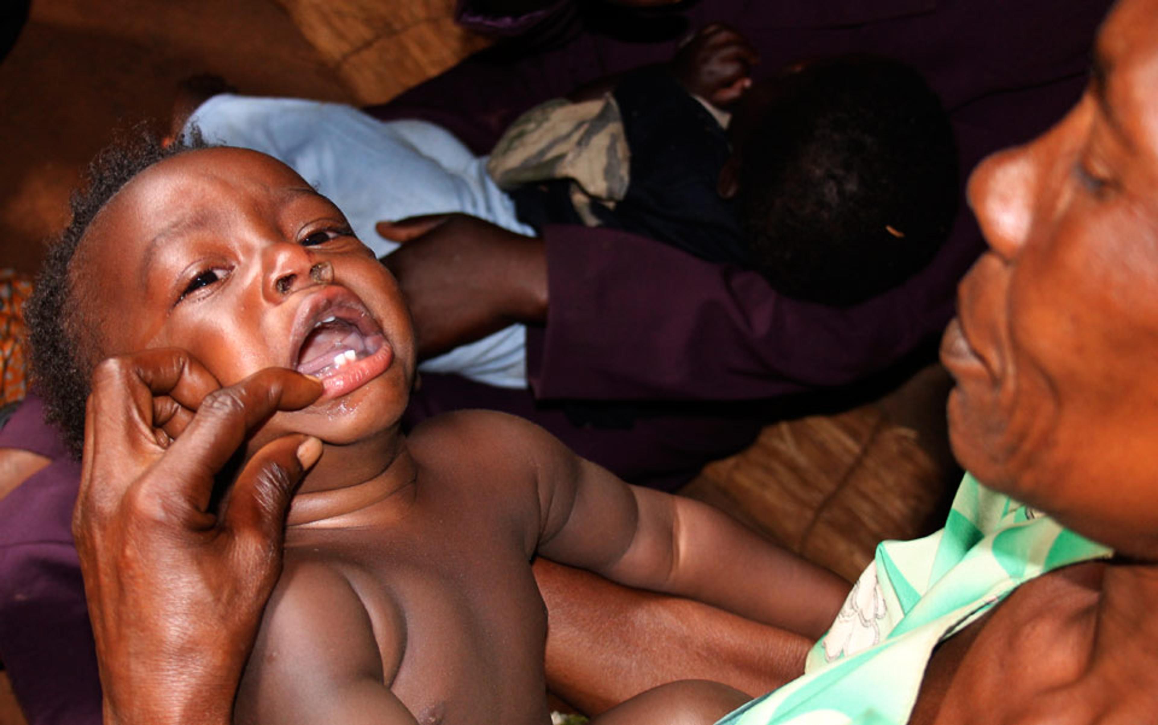 A crying baby being comforted by a woman holding open its mouth to reveal two baby teeth, with another child and adult in the background.