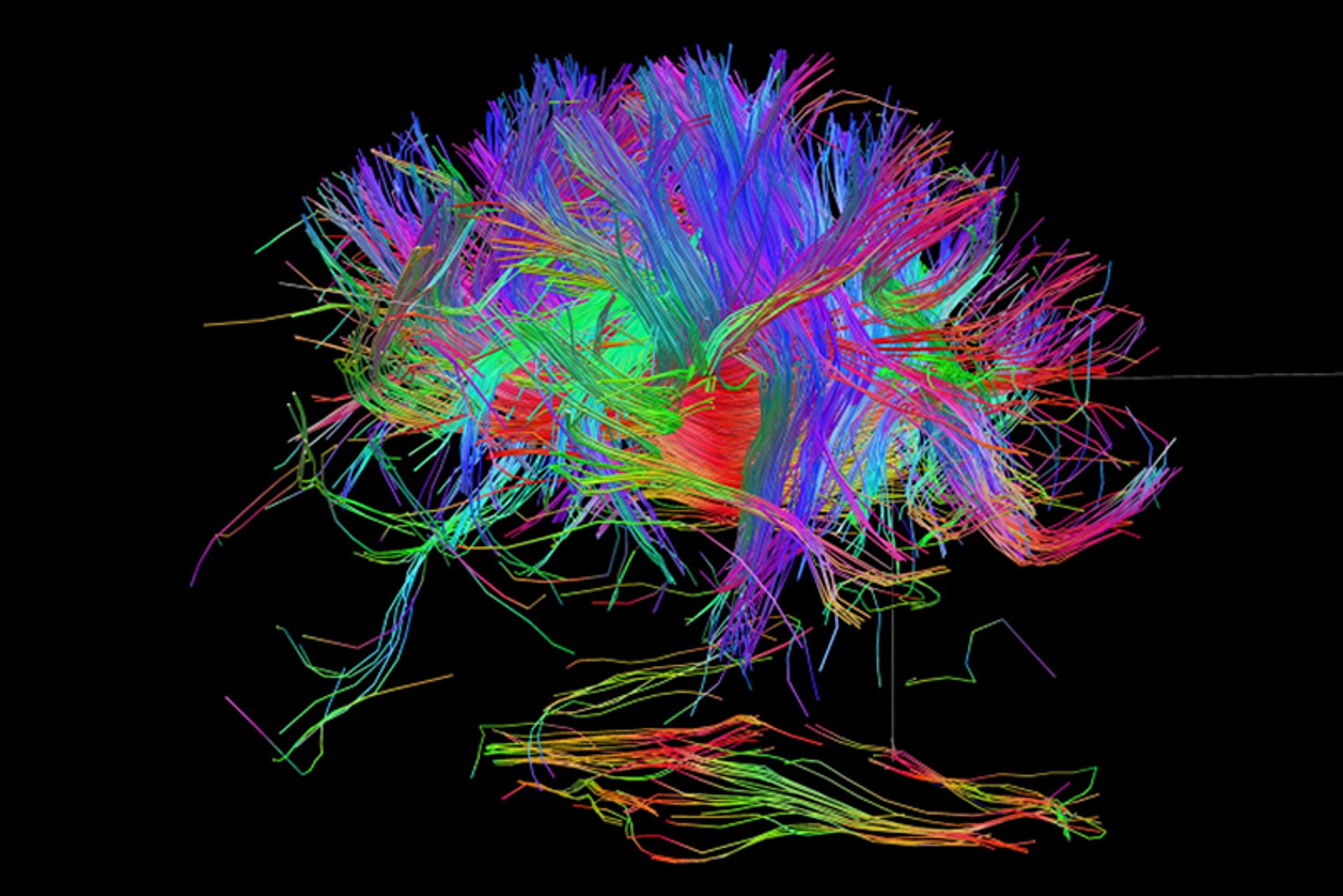 3D rendering of the brain’s neural network in vivid colours on a black background.